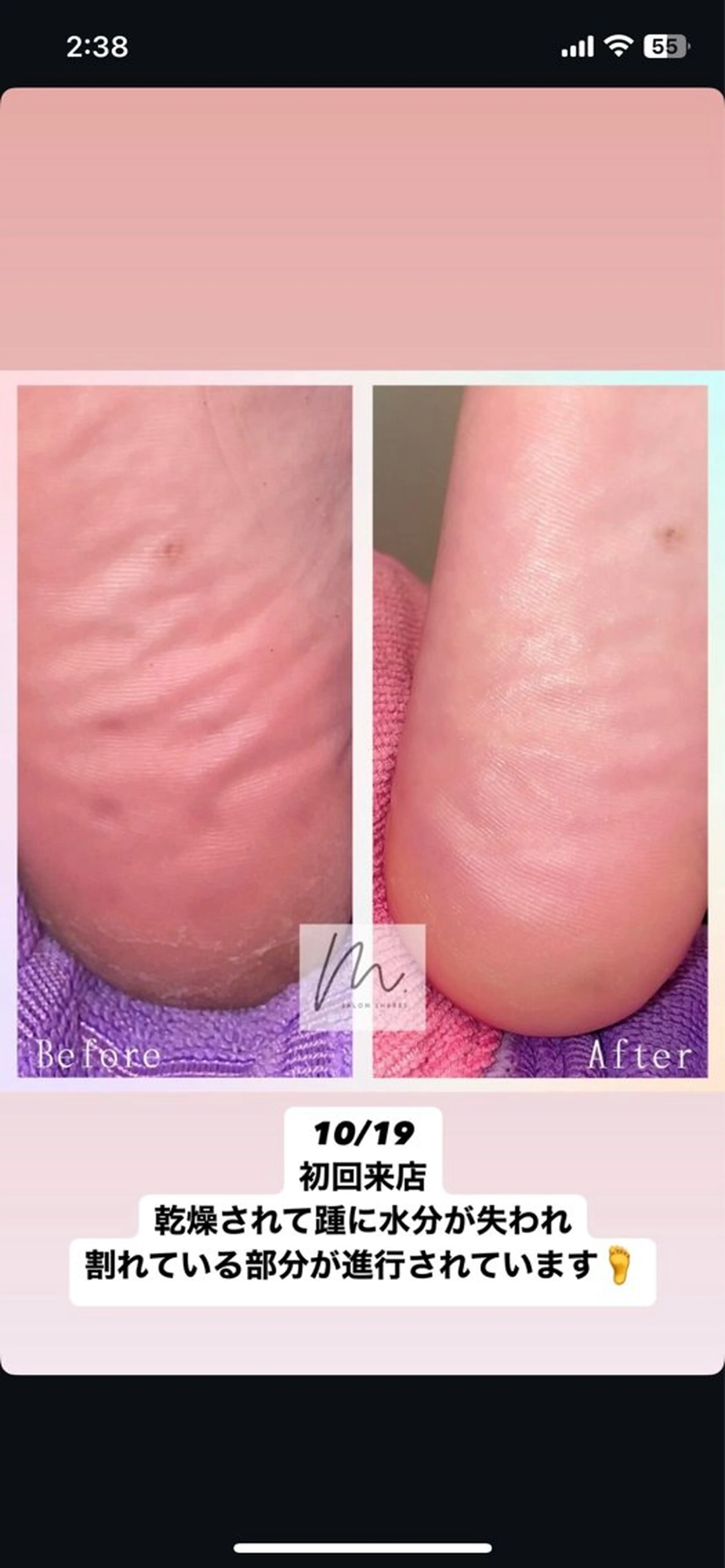 エステ リラク SHARES MADOKAのエステ・リラクイメージ