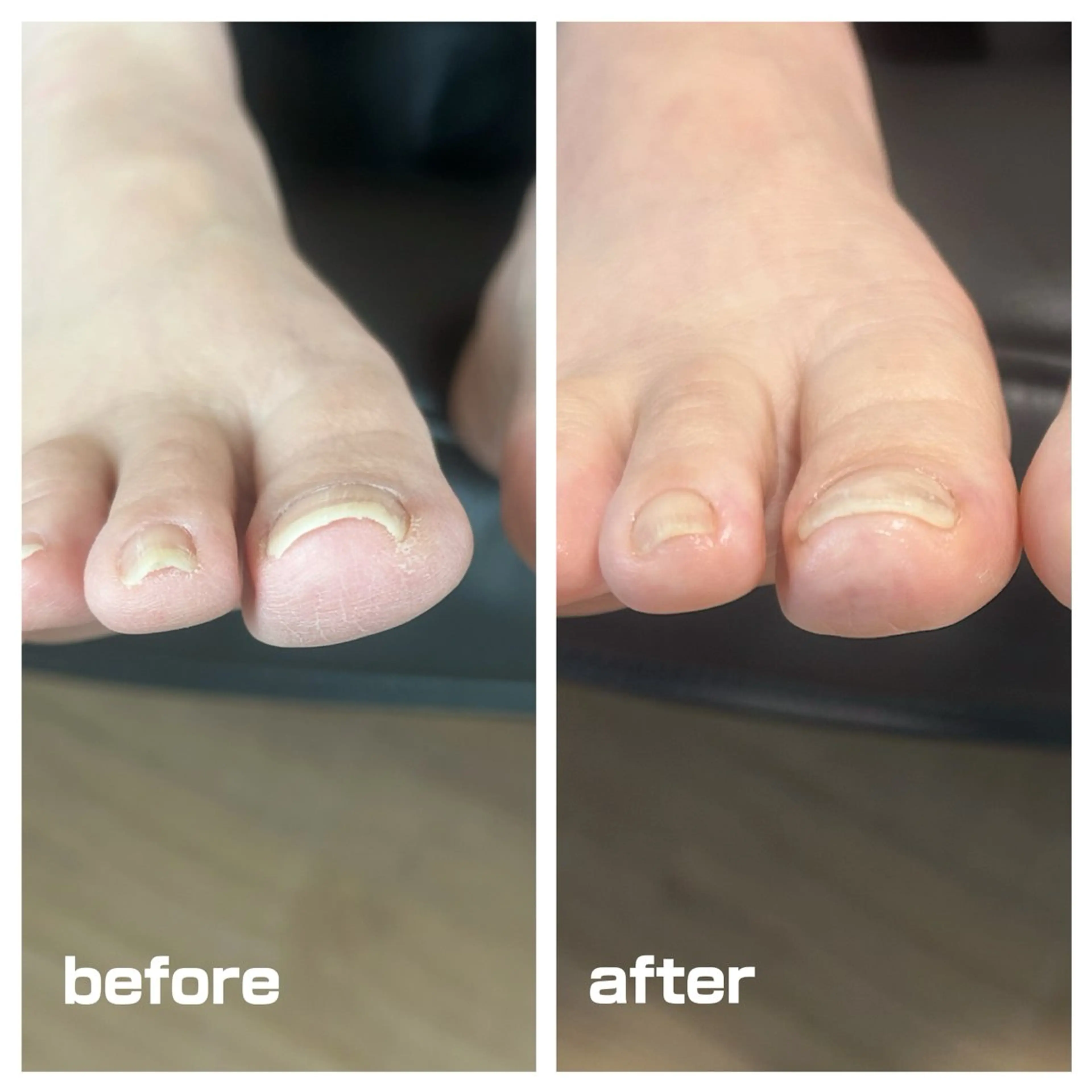 その他 巻き爪フットケアサロンKotori所属・フットケアサロン Kotoriのその他イメージ