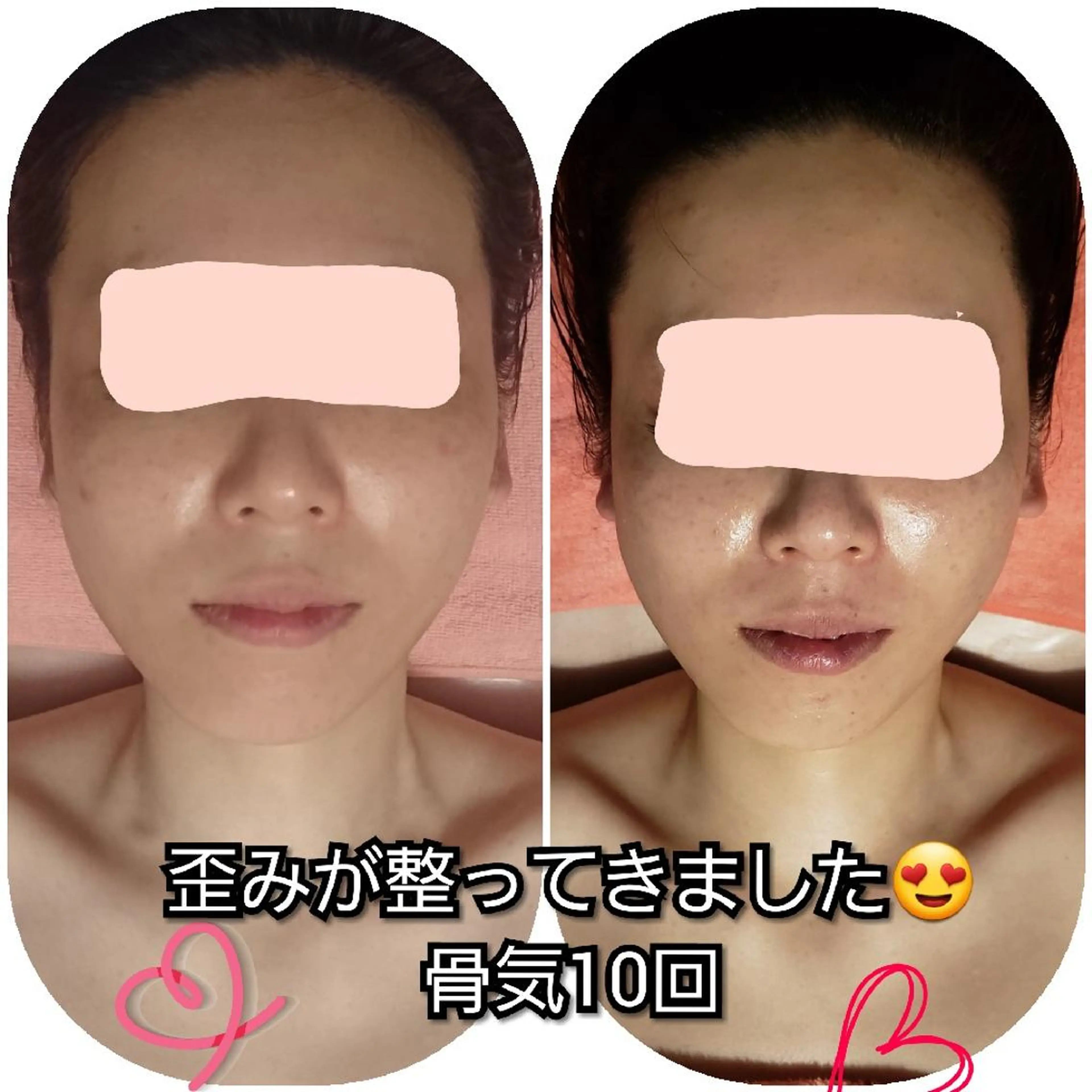 毛穴ケア くすみ肌 ハーブピーリングのエステ・リラクイメージ