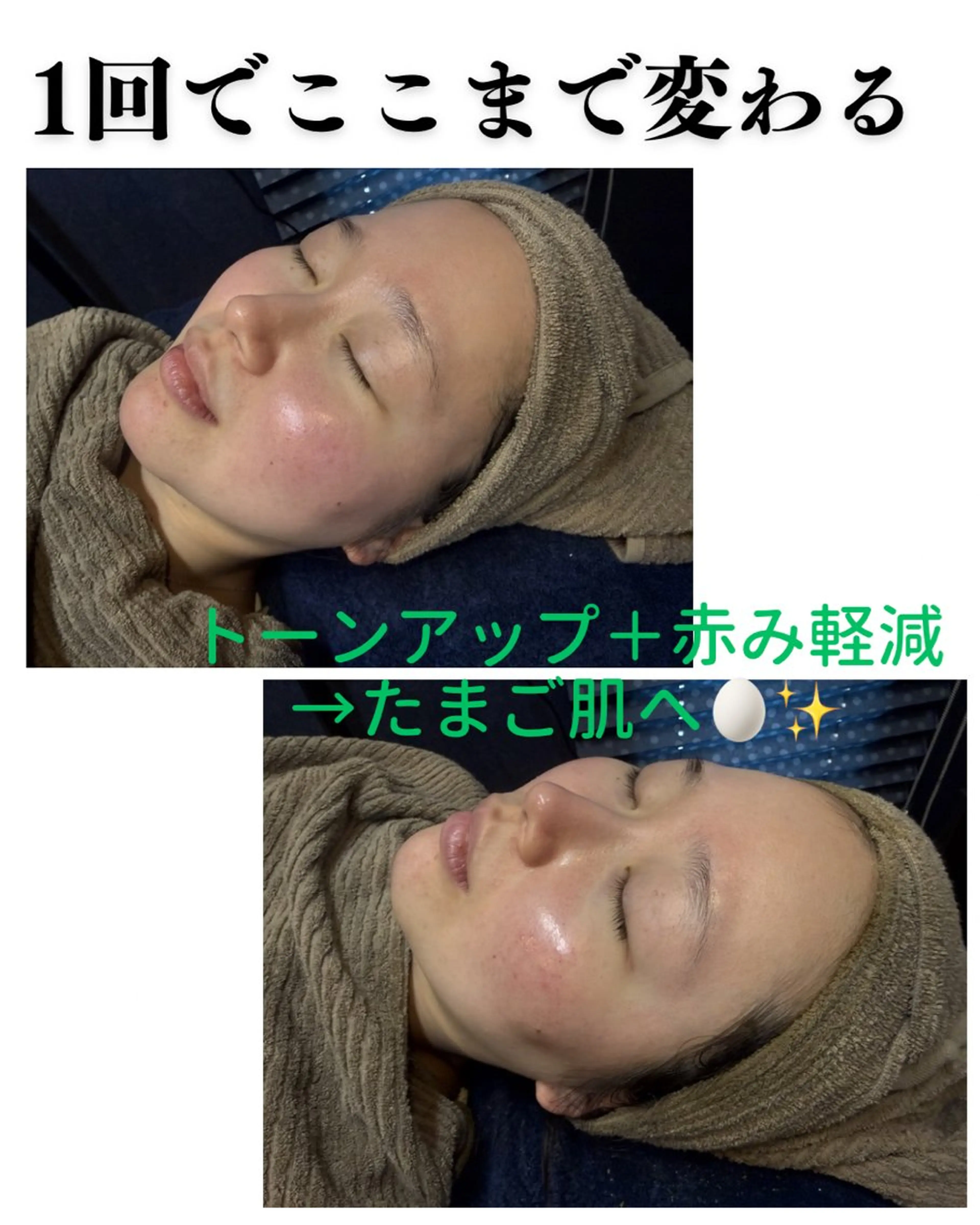 エステ リラク ハーブピーリング専門 店Oneのエステ・リラクイメージ