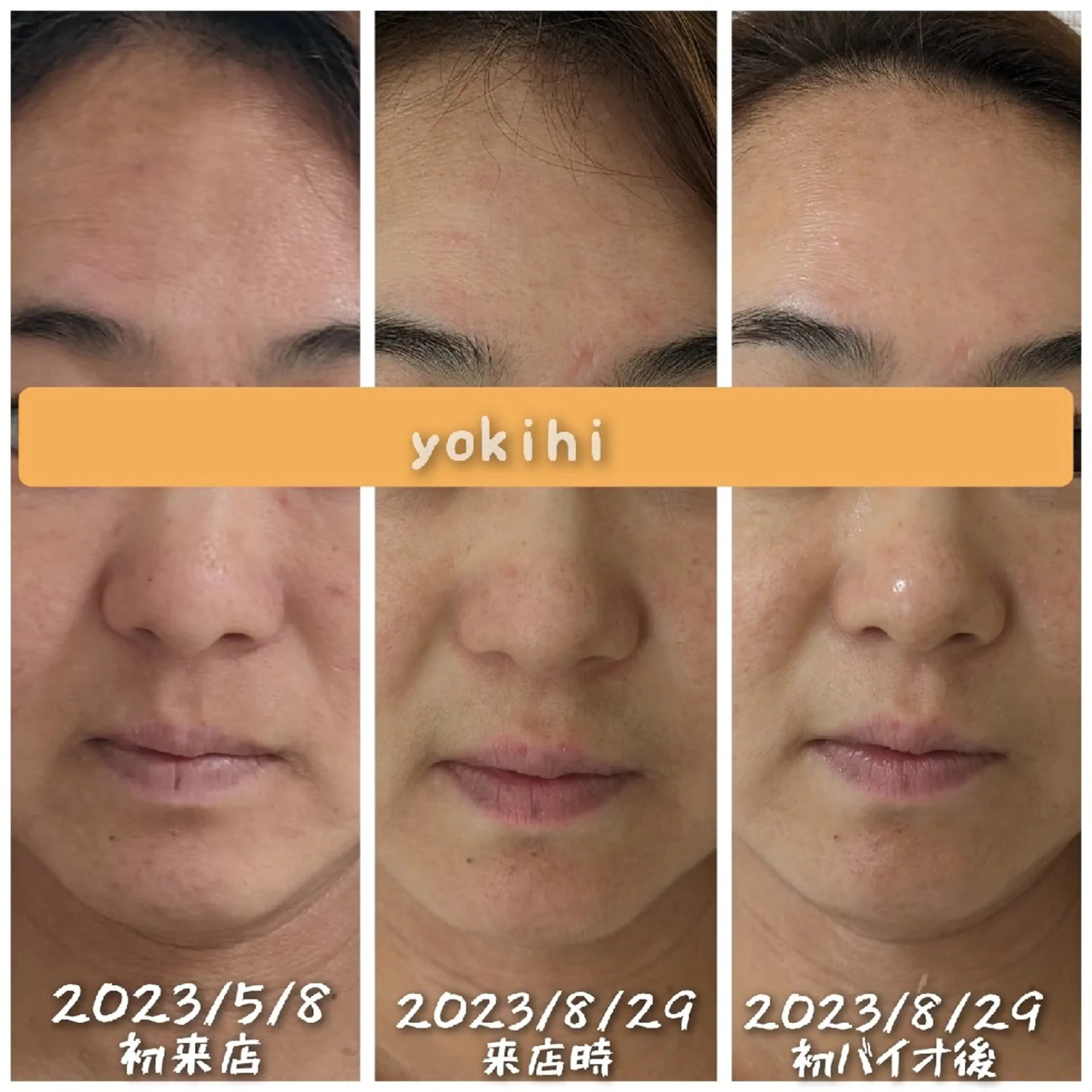 結果が出るスキンケア 肌質改善/まつパのエステ・リラクイメージ