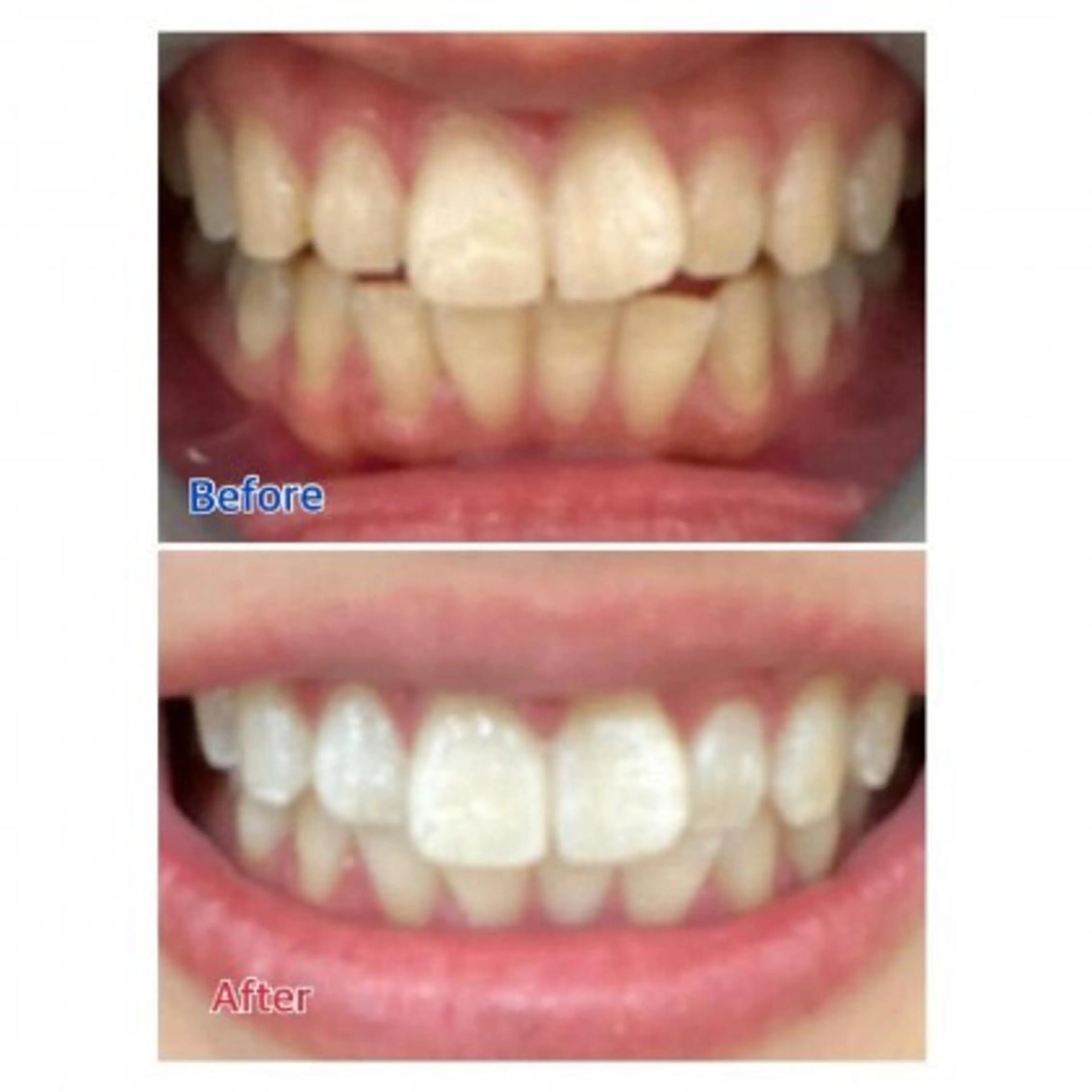 Ｍ渋谷 ホワイトニングのエステ・リラクイメージ