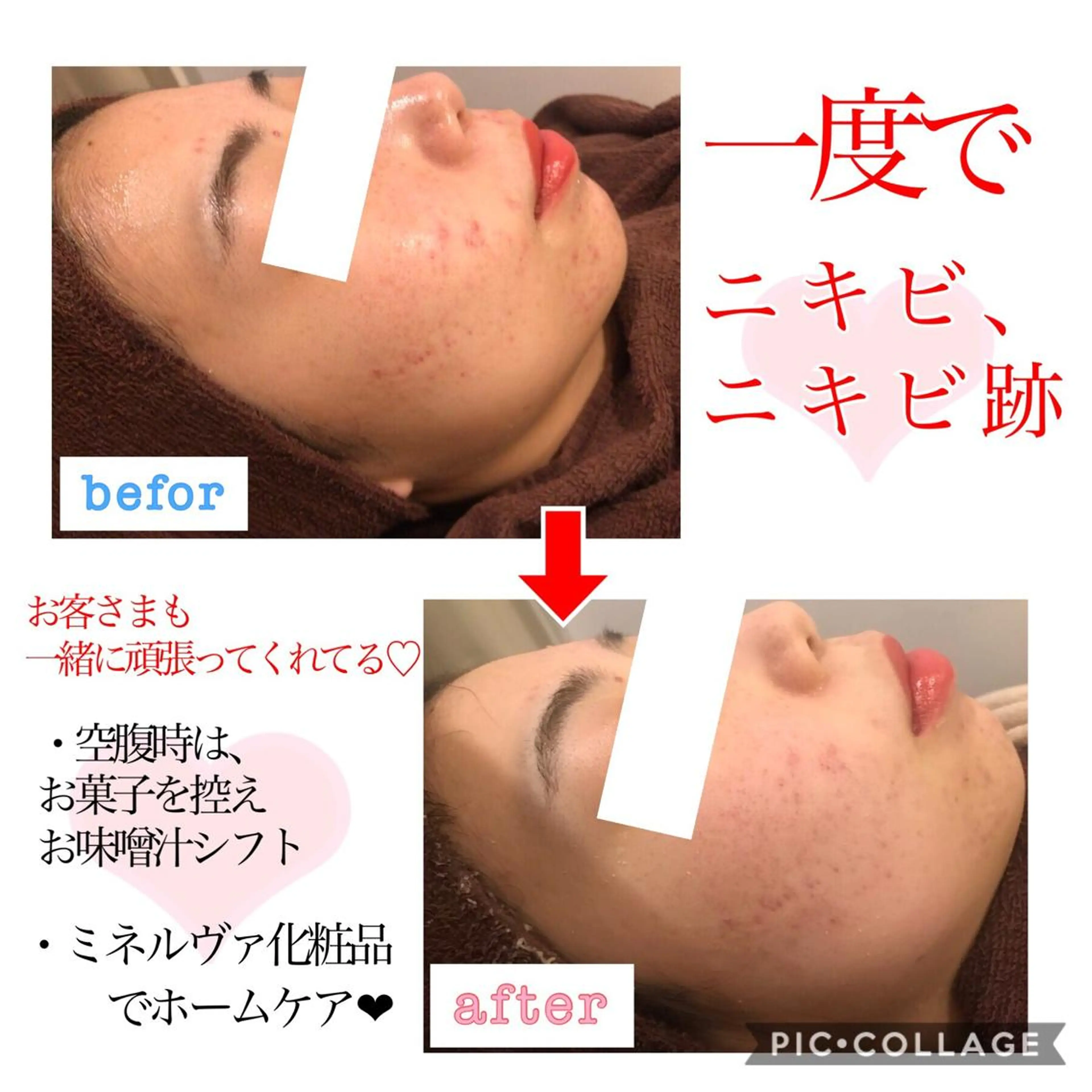 セミロング カラー パーマ ヘアアレンジ メンズ キッズ ネイル マツエク・マツパ 金の糸脱毛 産毛ケア専門のエステ・リラクイメージ