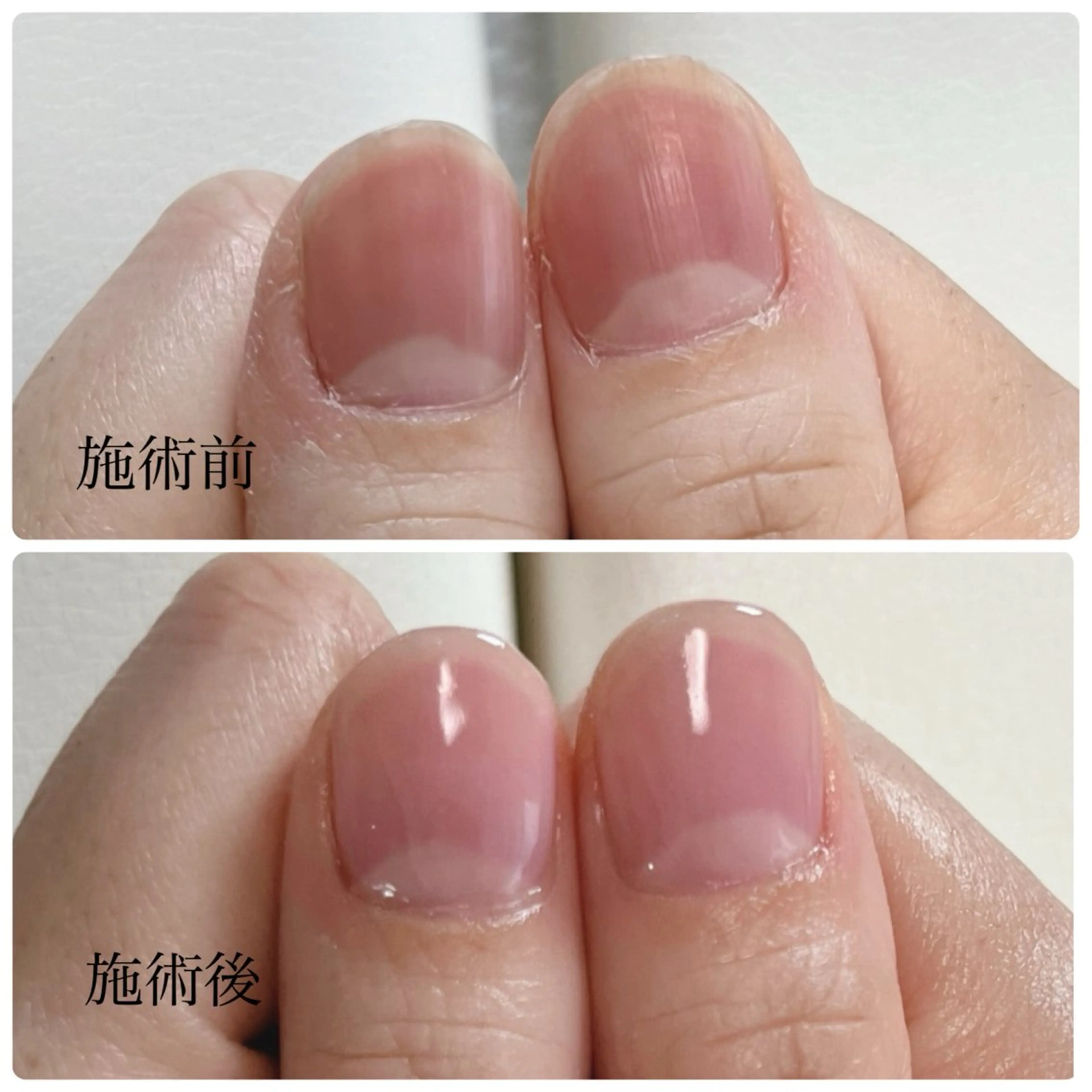 ネイル nailcare リリネルのネイルデザイン