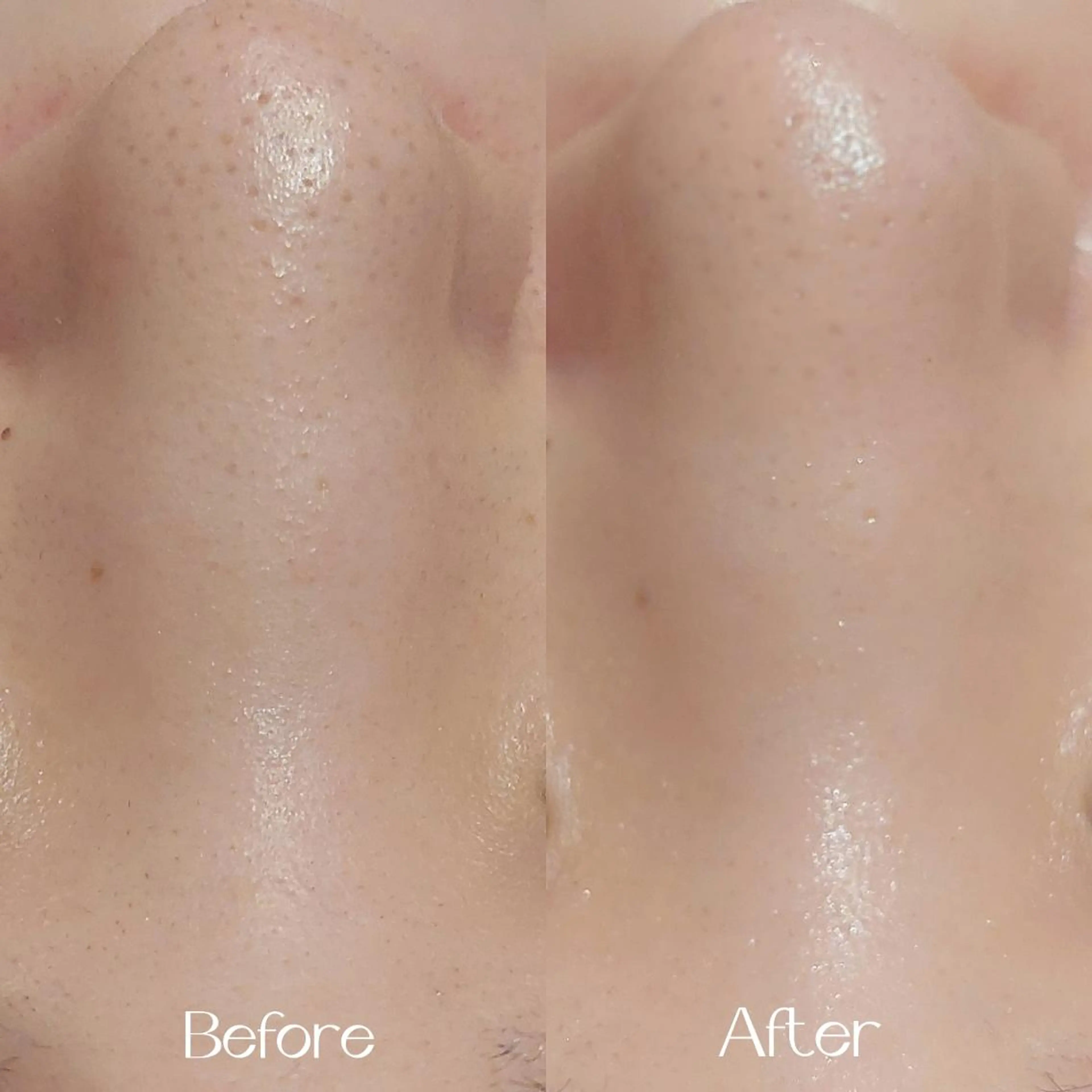 エステ MyFairLady miuのエステ・リラクイメージ