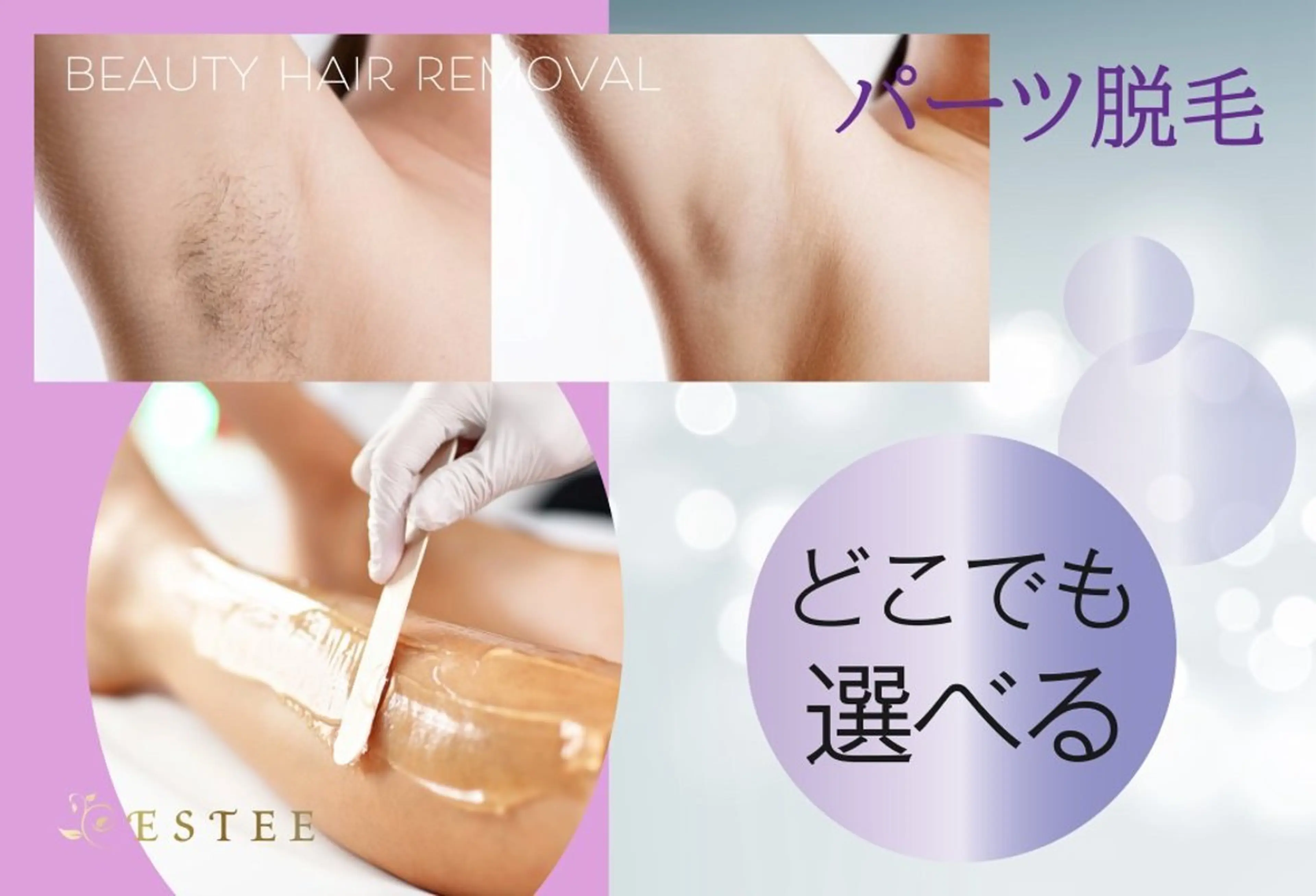 【レディース脱毛】 VIOビキニライン脱毛の写真