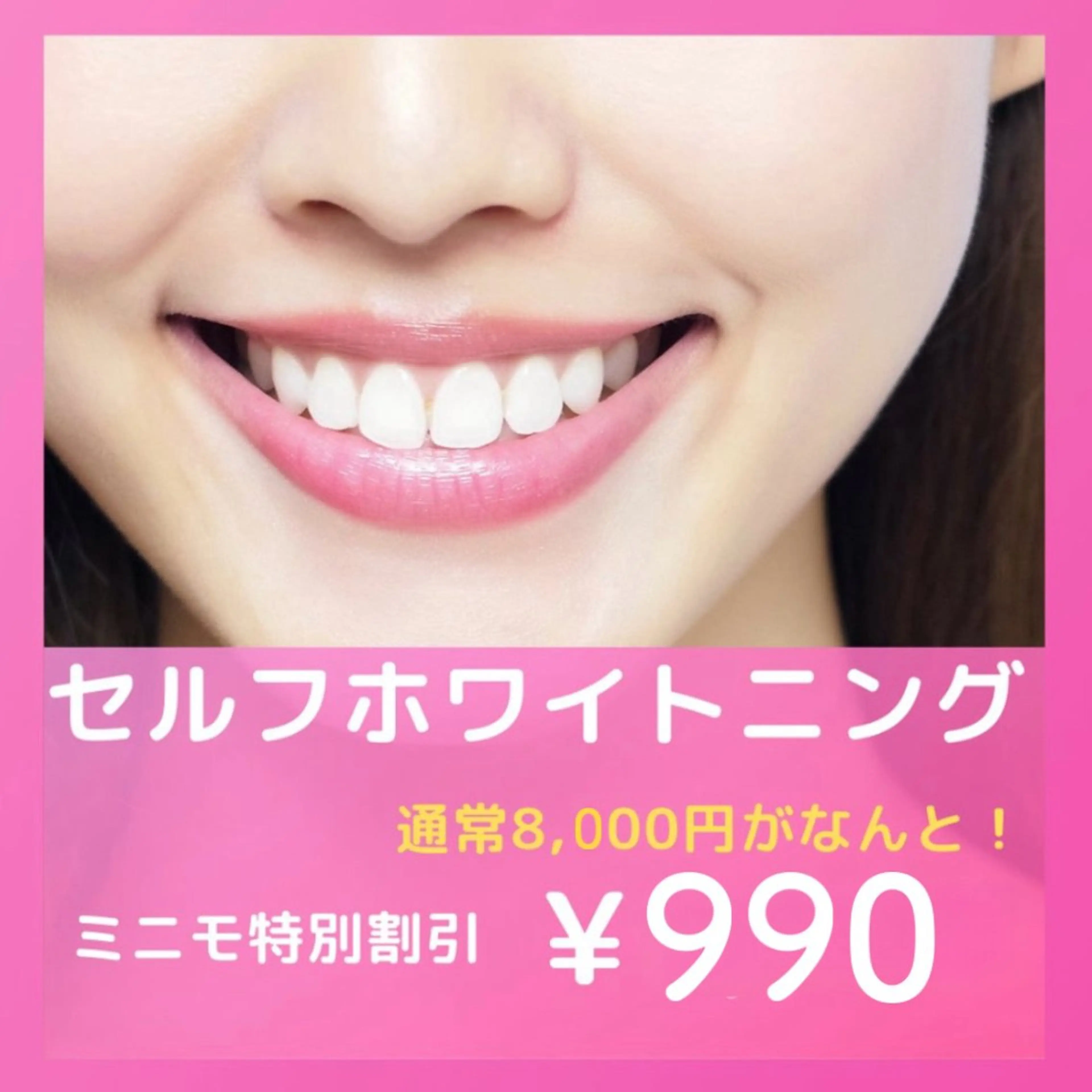 その他 セルフホワイトニング エクシア恵比寿店のその他イメージ