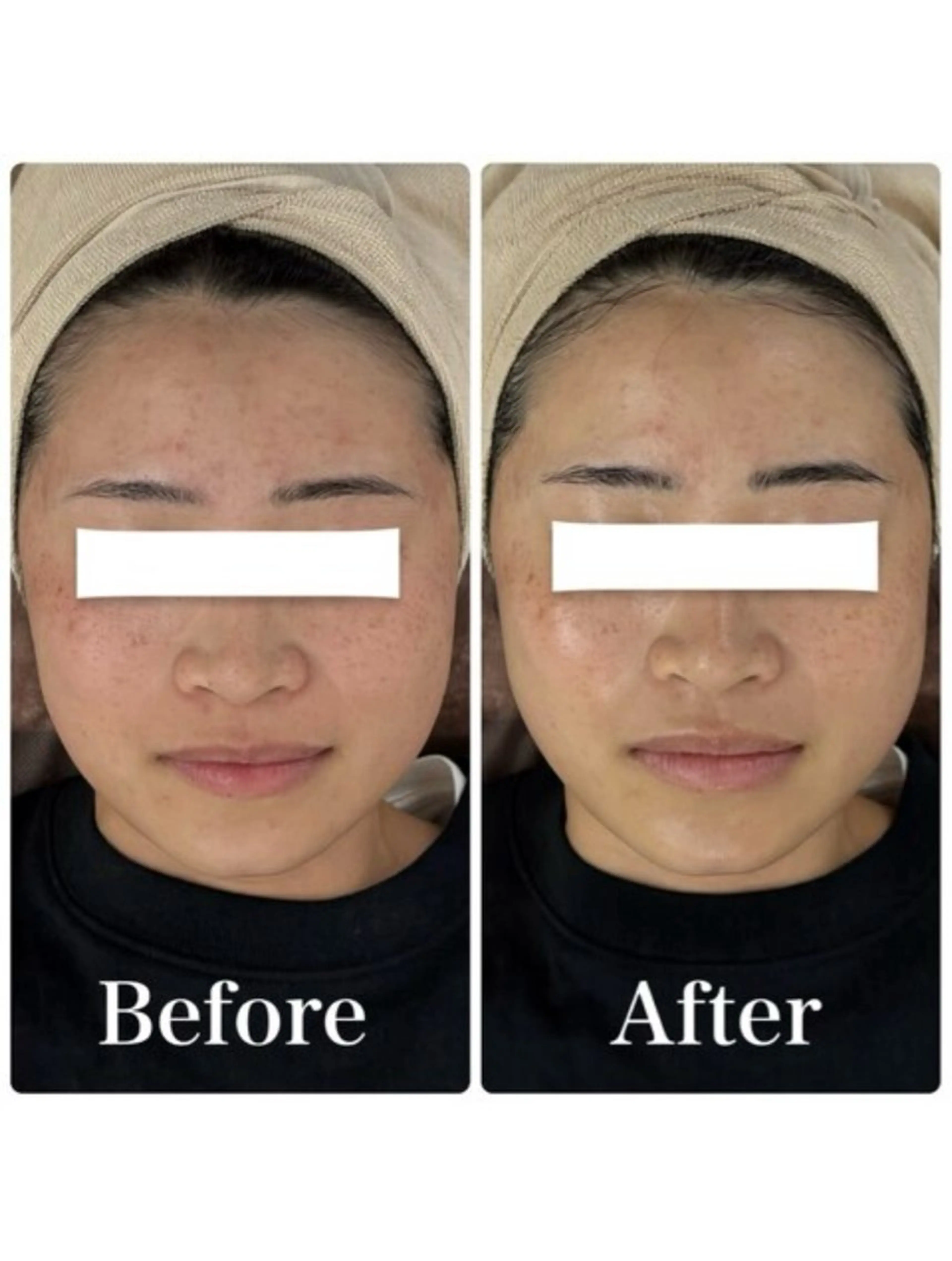 メンズ エステ 小顔フェイシャル 専門店Soarのエステ・リラクイメージ