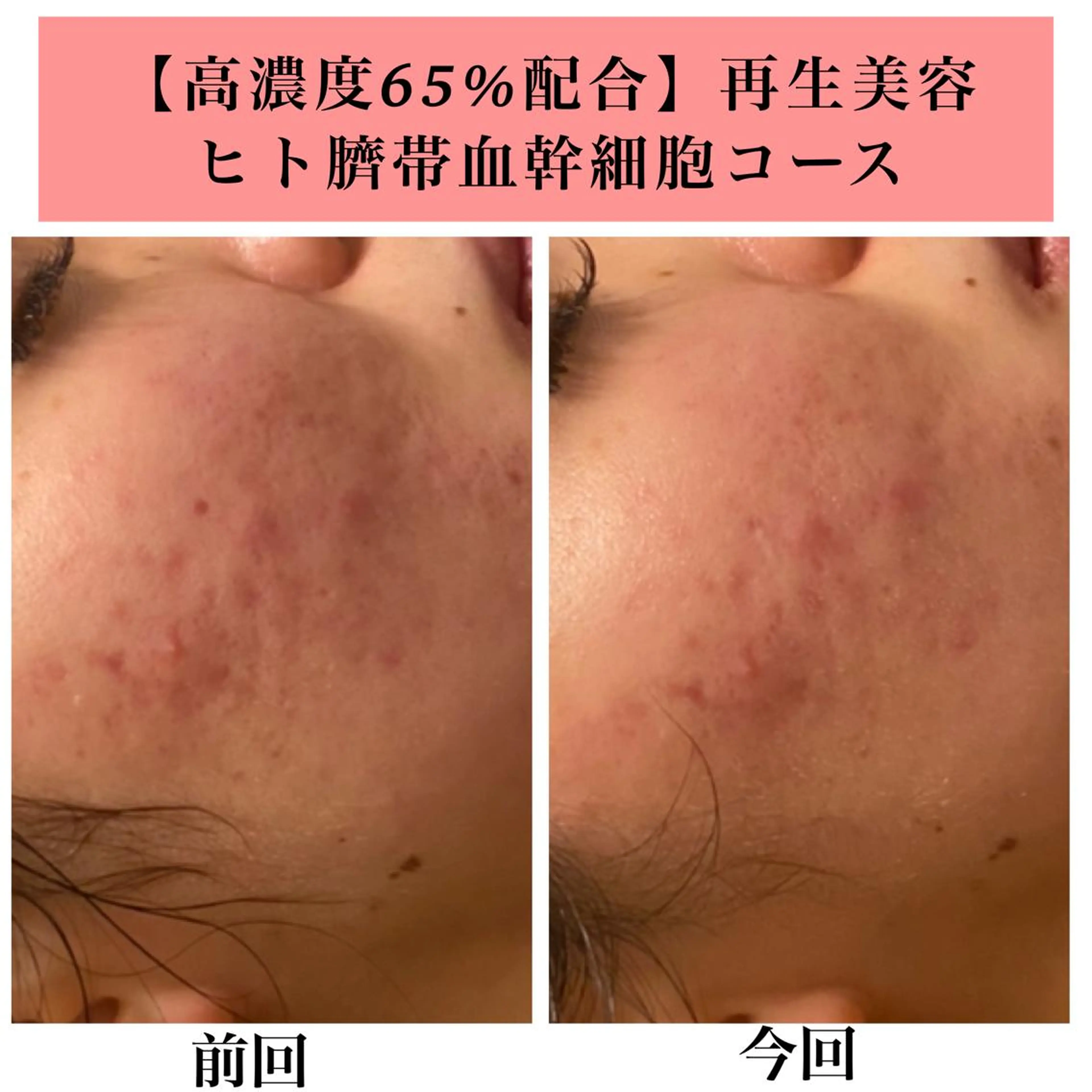 エステ リラク Bellesthe （ベルエステ）のエステ・リラクイメージ