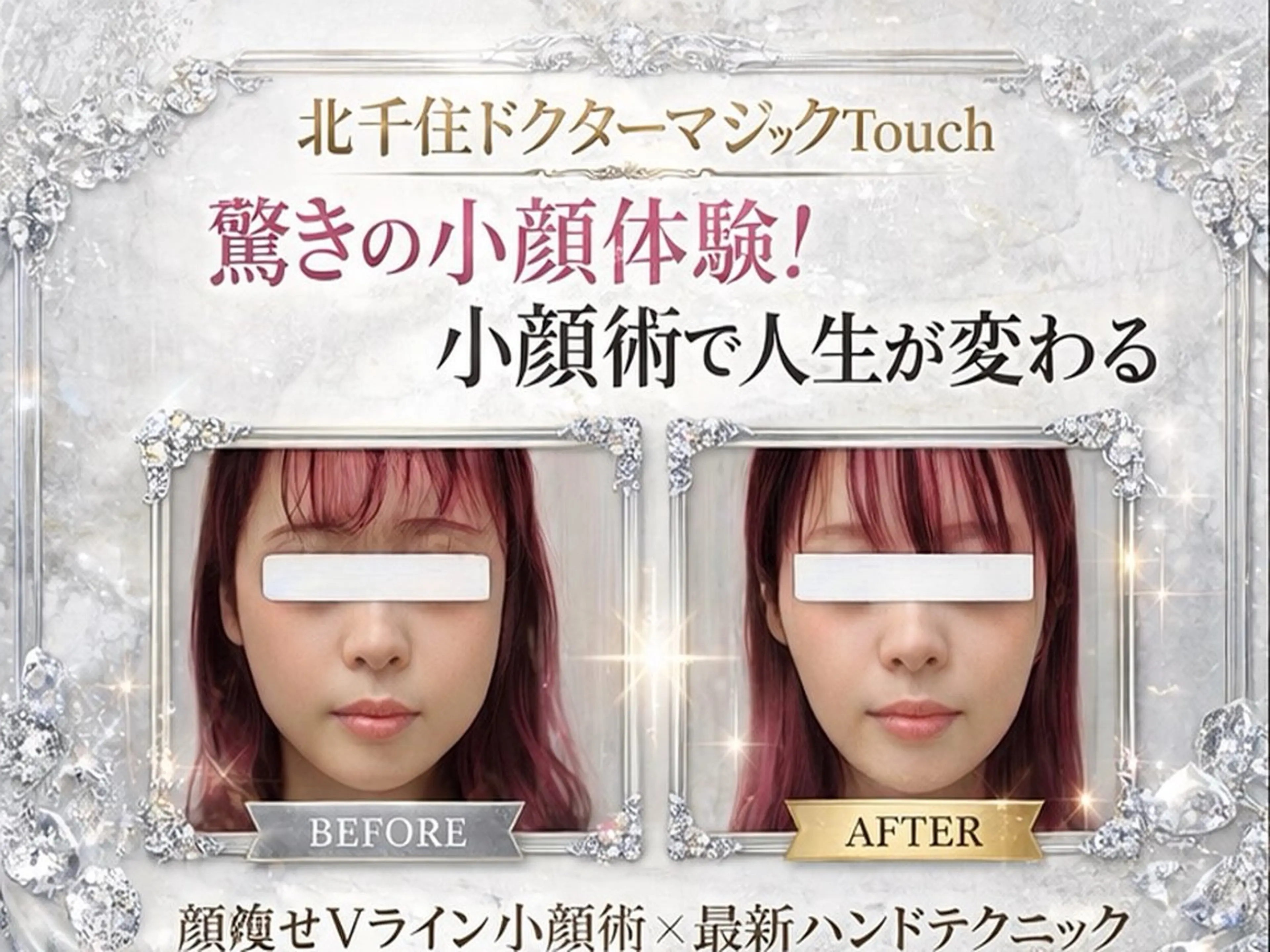 【ミニモ限定】人気No.1★劇的Vライン形成+強力リフトアップ矯正|たるみ・エラ張り撃退「施術50分〜」の写真