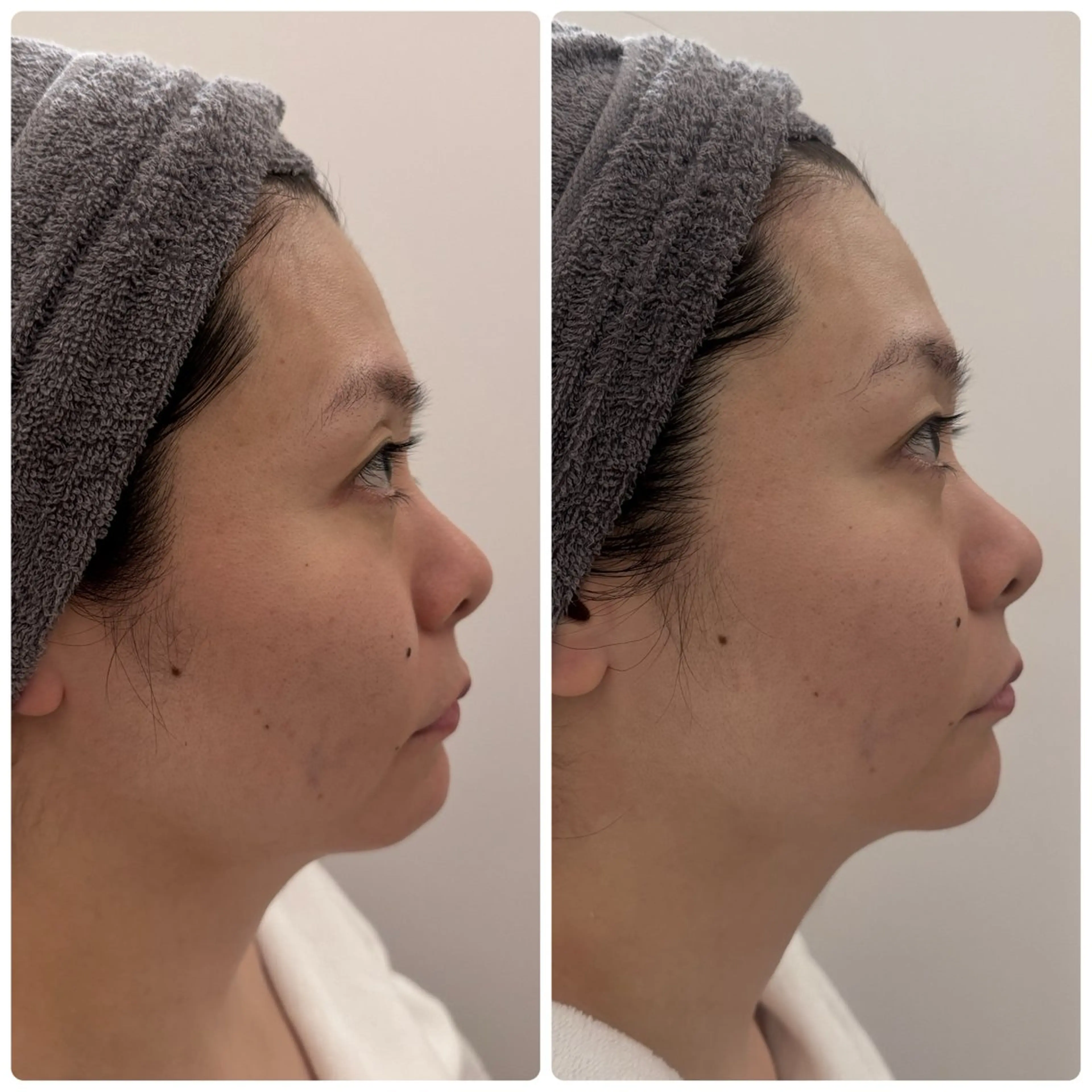 エステ アピタ千代田橋店 POLA THE BEAUTY所属・アピタ千代田橋店 ポーラ 楊のエステ・リラクイメージ