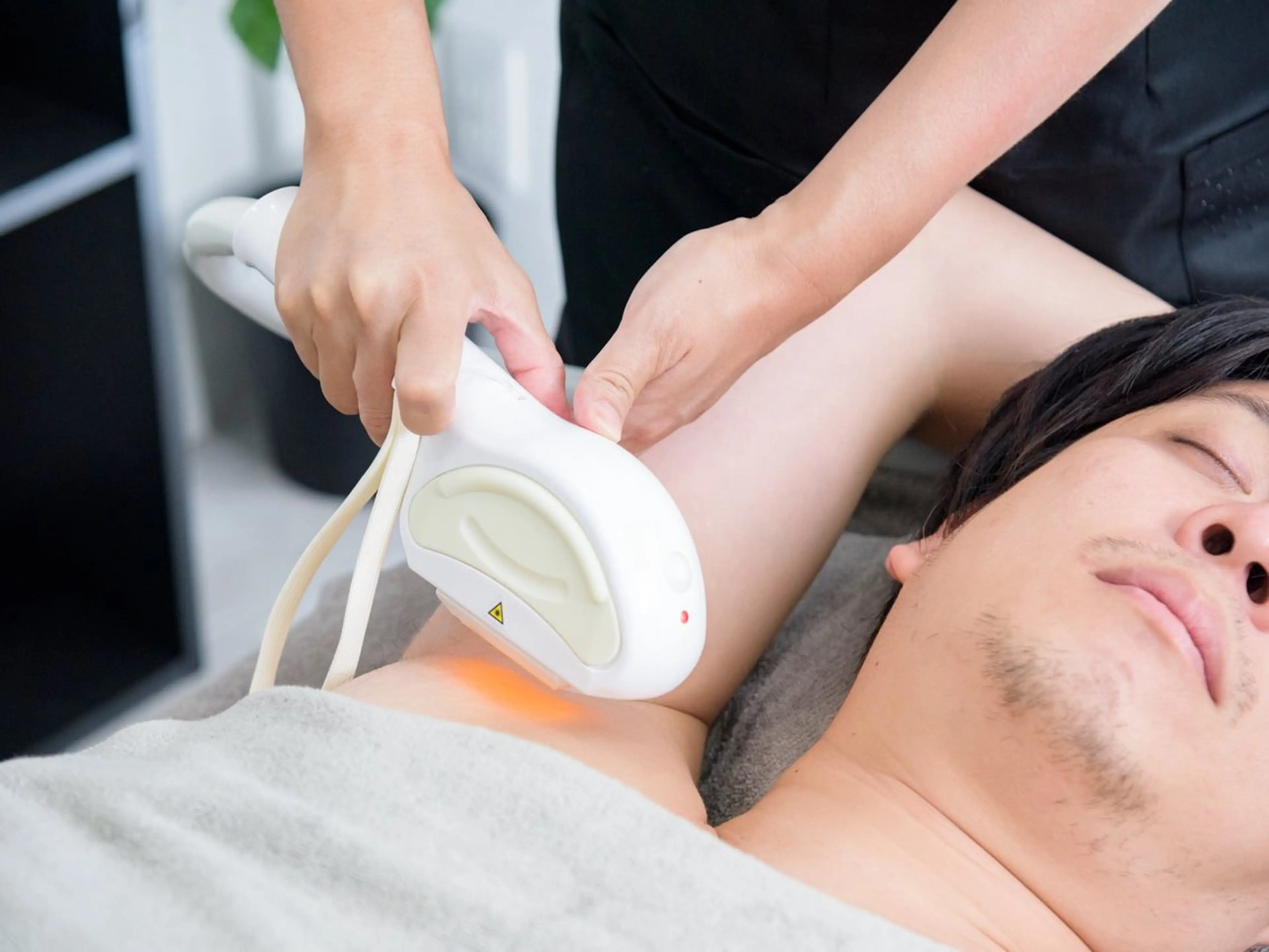 メンズワキ脱毛☘️メンズにも大人気♂の写真