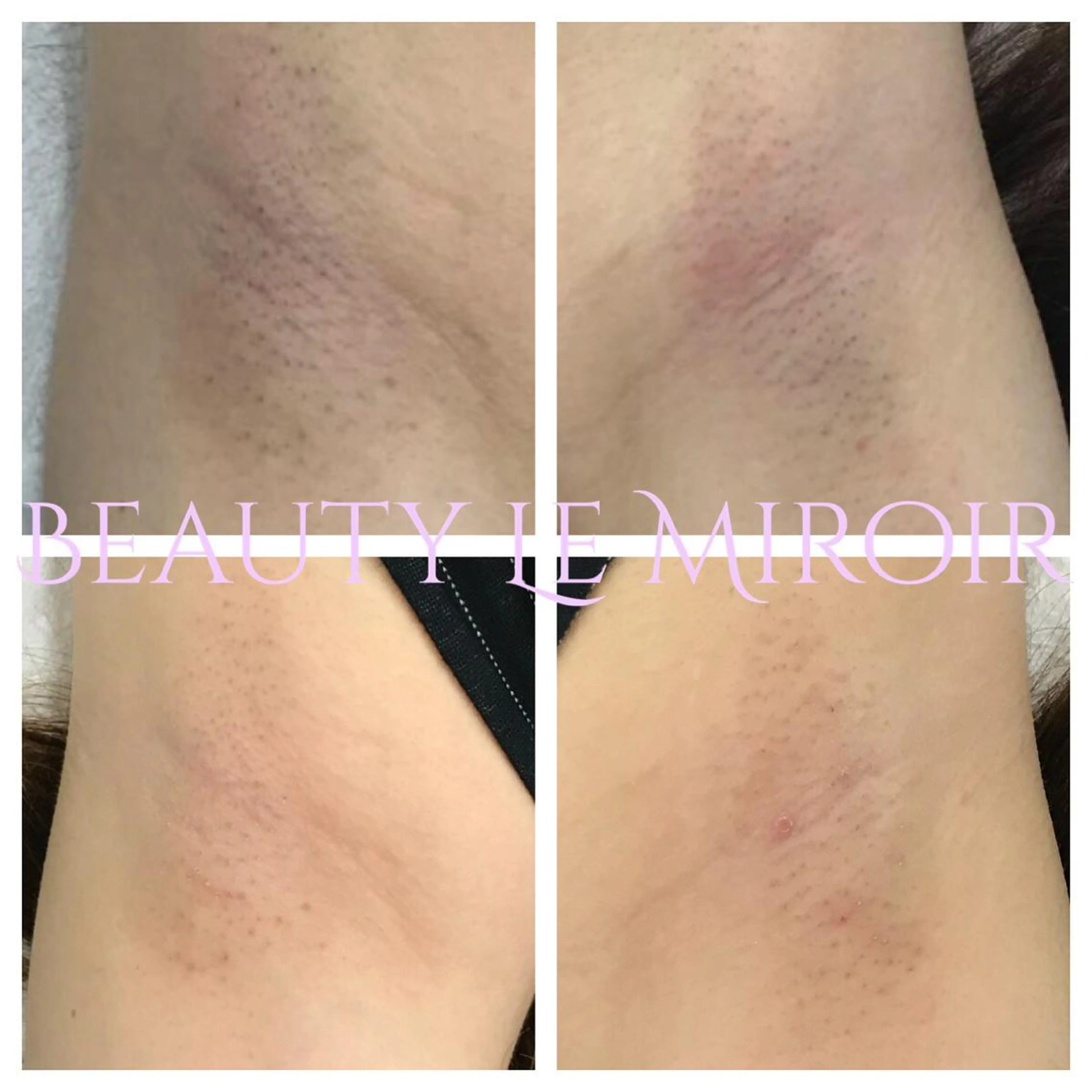 脱毛 ビューティー ミロワールのエステ・リラクイメージ