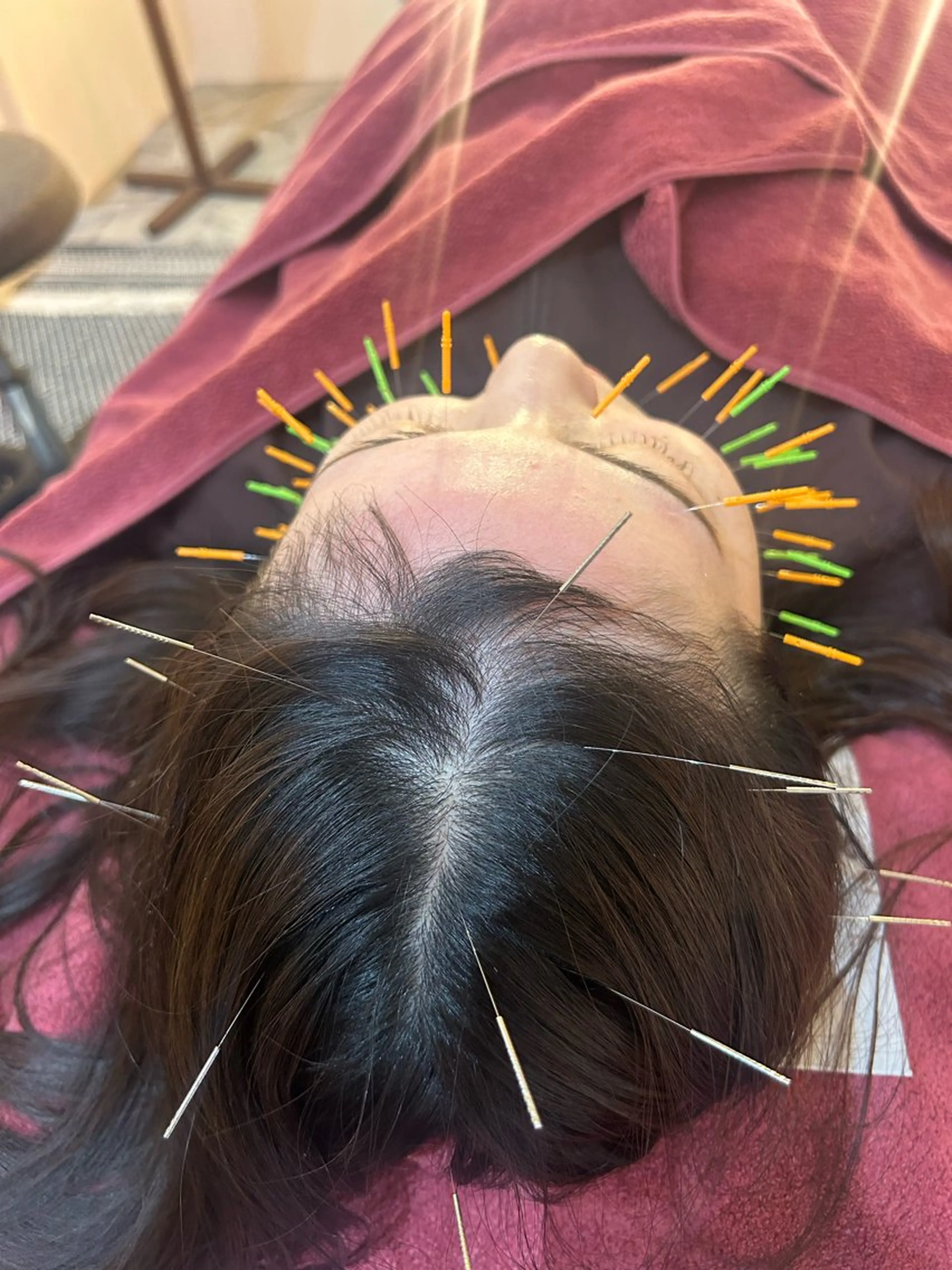 エステ リラク 美容鍼灸女性専用 りんご鍼灸治療院のその他イメージ