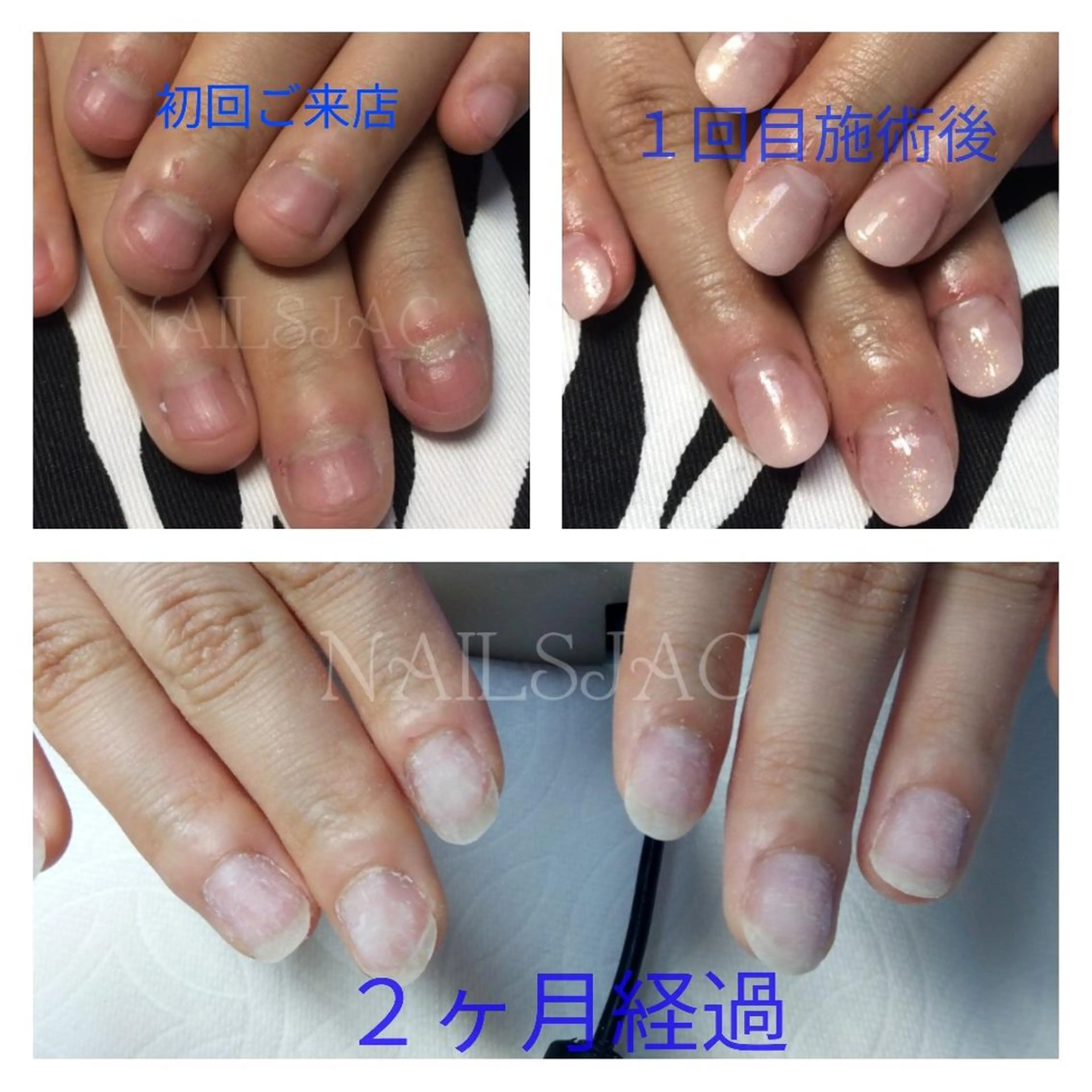 ネイル NAILS JACのネイルデザイン