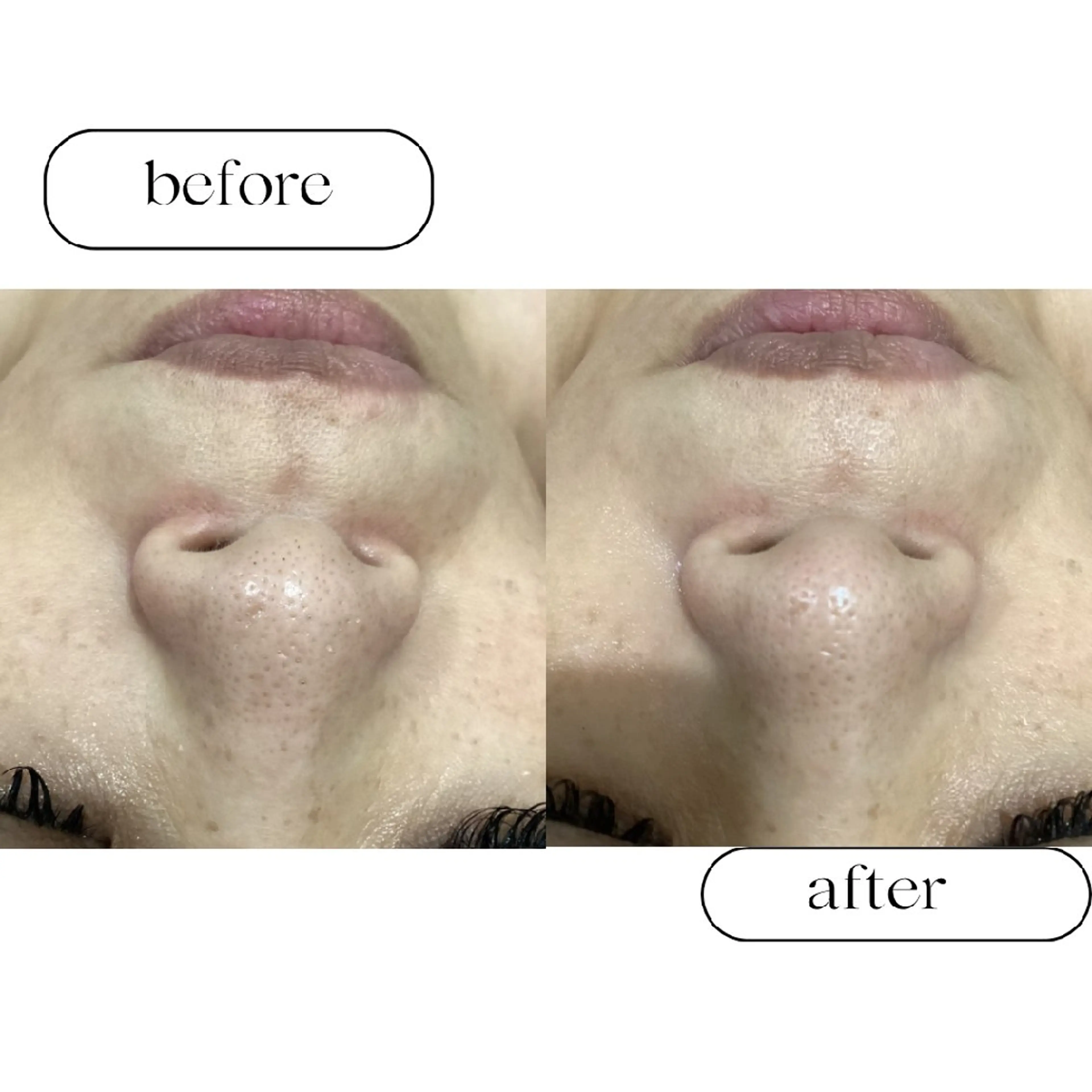 美肌専門サロン RUBONのエステ・リラクイメージ