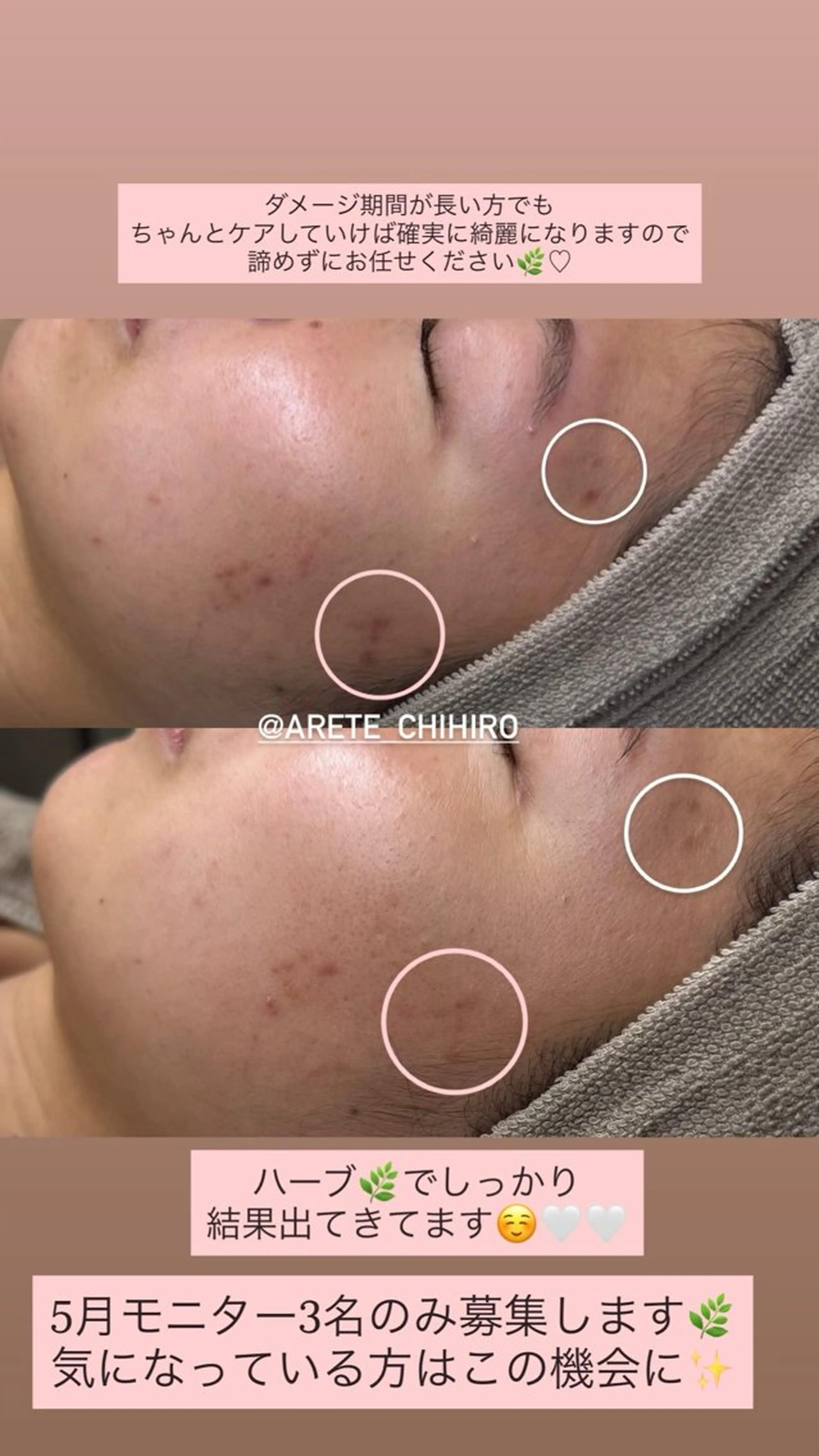 エステ リラク salon aretéのエステ・リラクイメージ