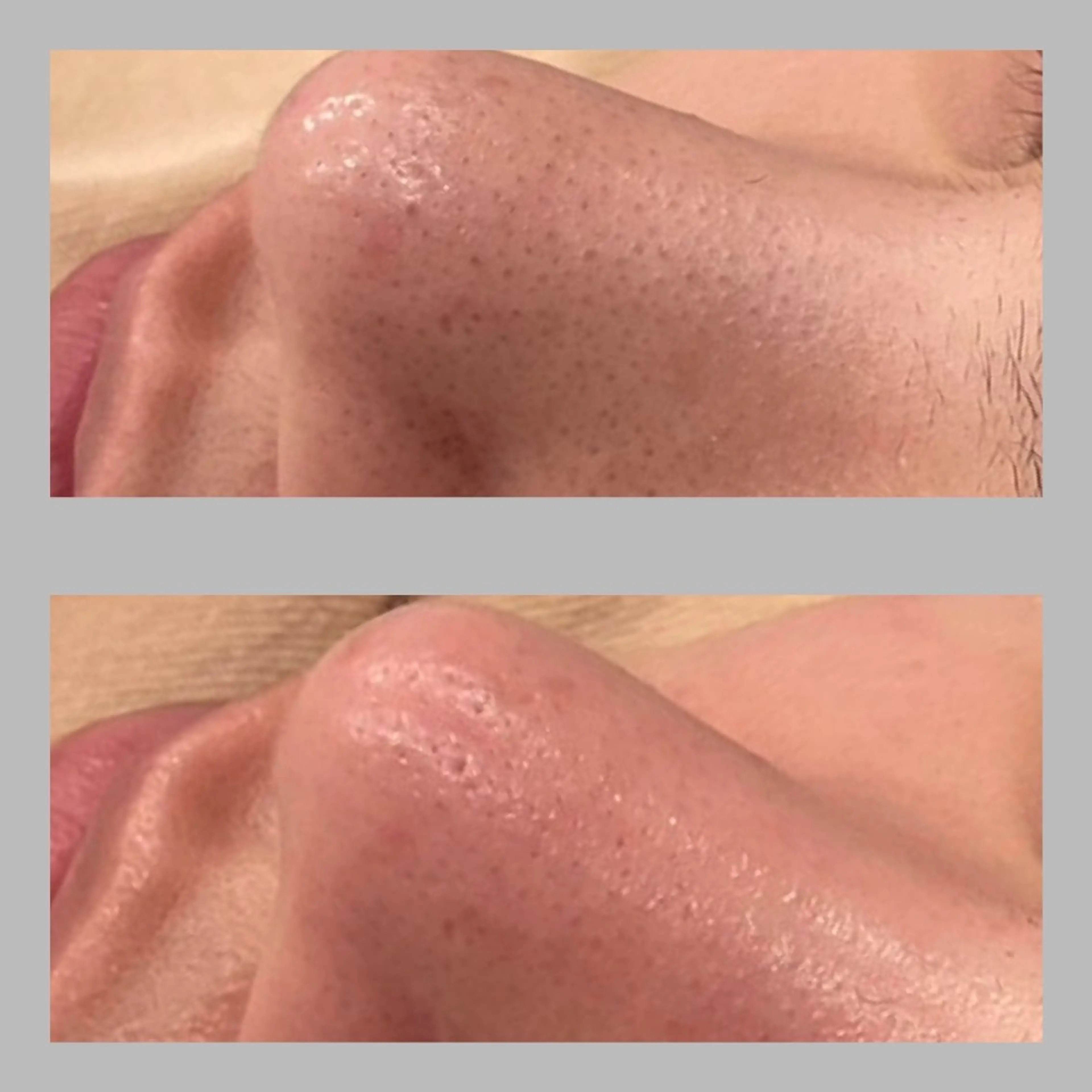 エステ ベル チェリカ 三城のエステ・リラクイメージ