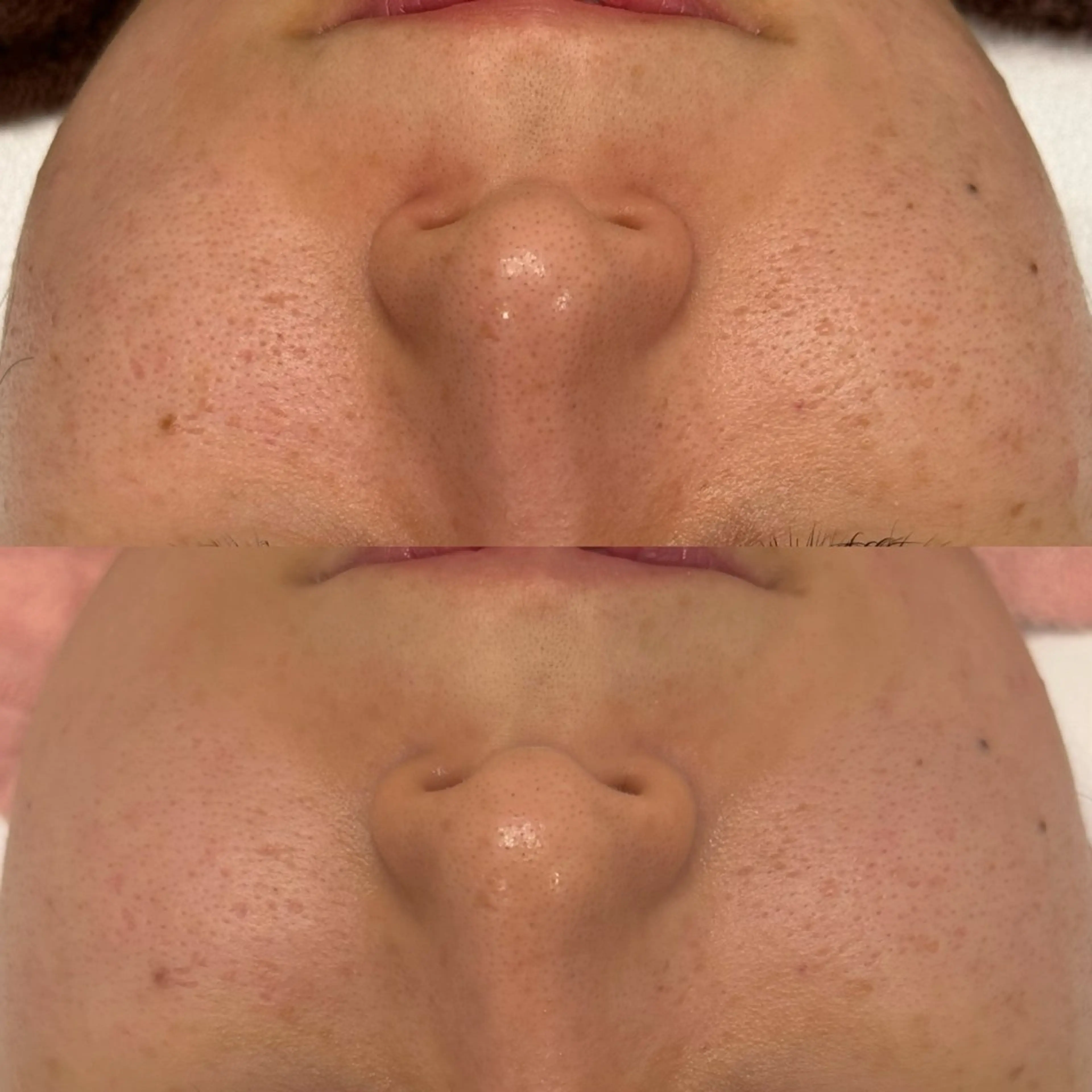 べアール所属・小顔/毛穴/ニキビ salon bealのエステ・リラクイメージ