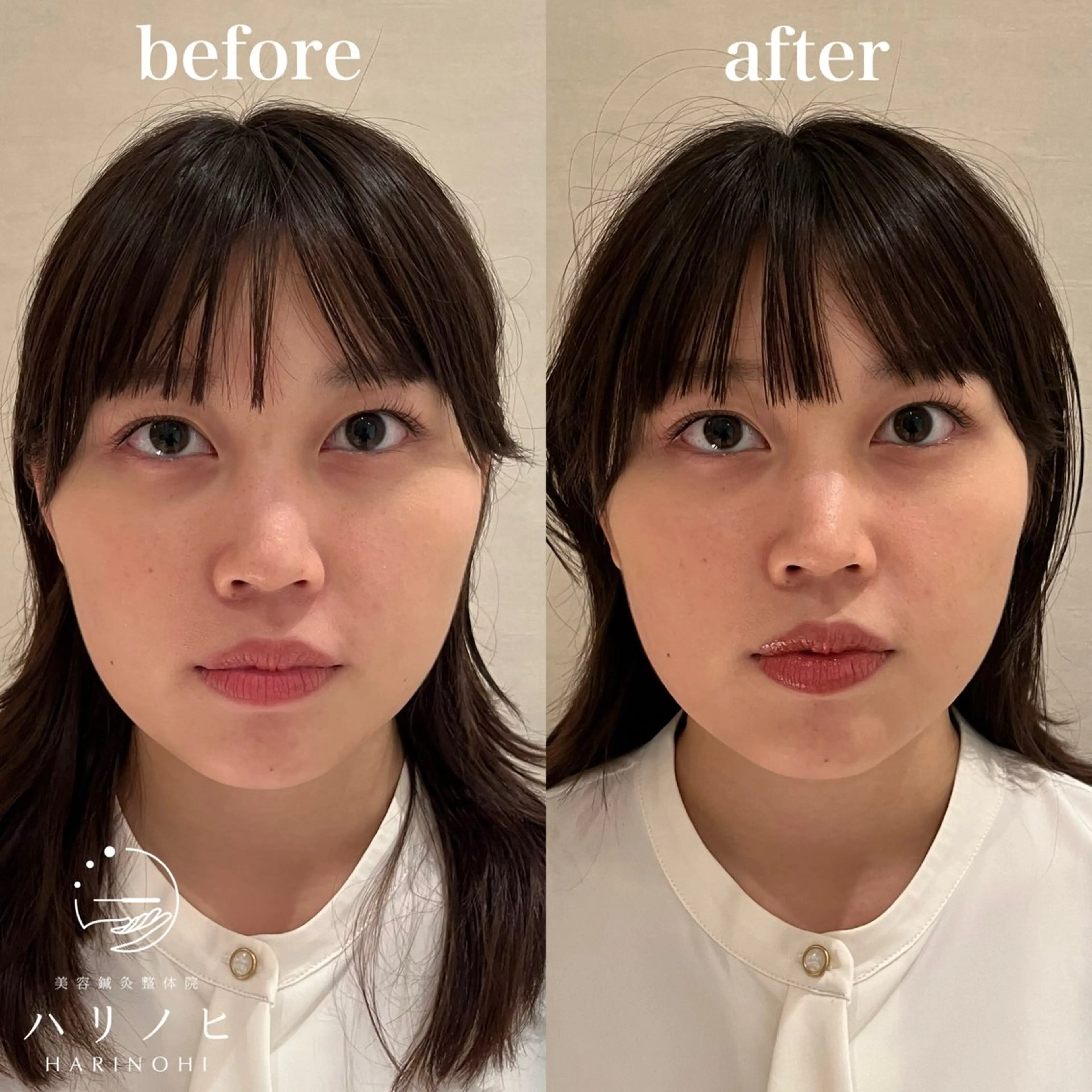 エステ リラク 美容鍼灸整体院 ハリノヒ大阪院のエステ・リラクイメージ