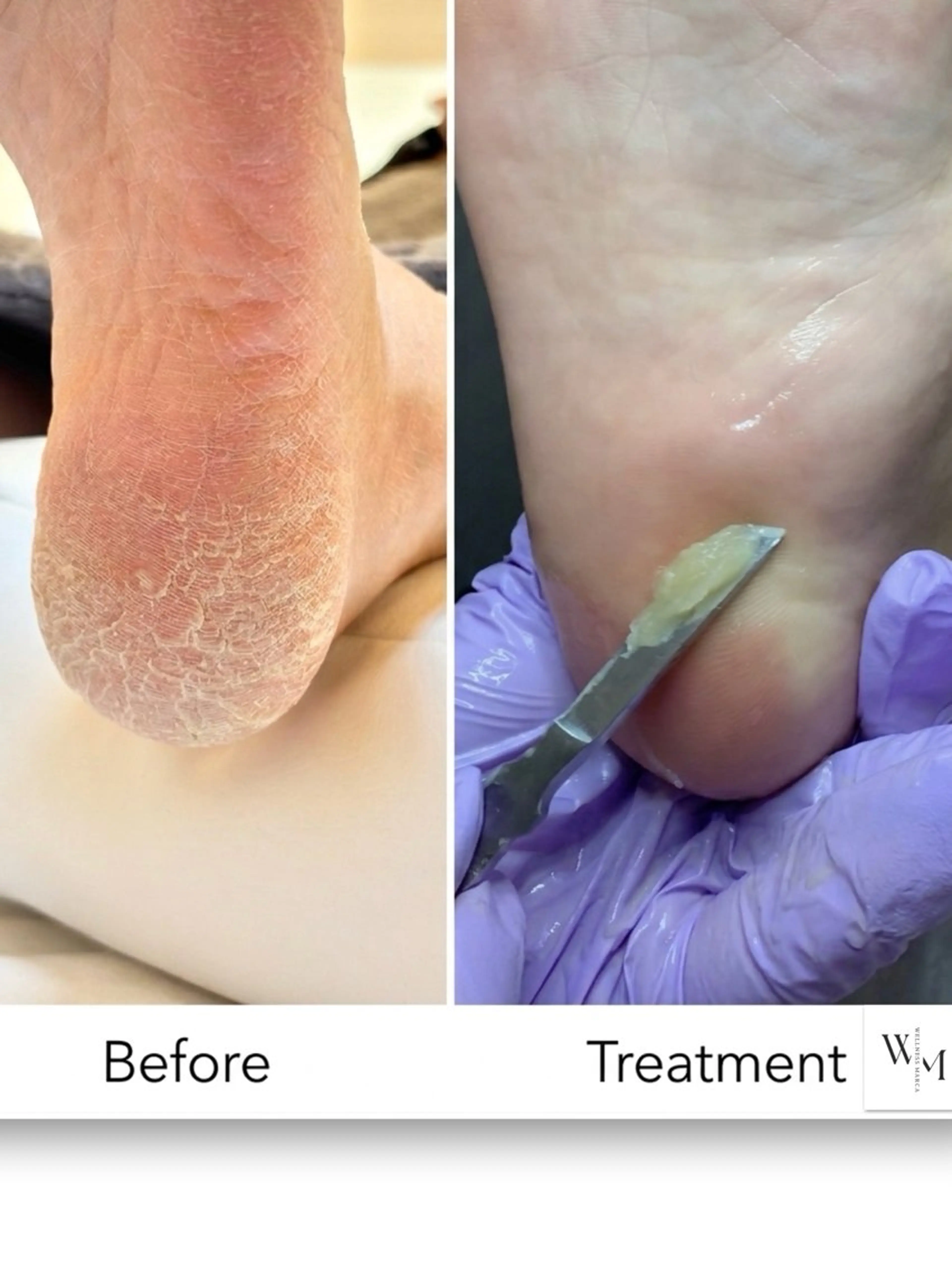 エステ 【メンズサロン】 MARCAのネイルデザイン