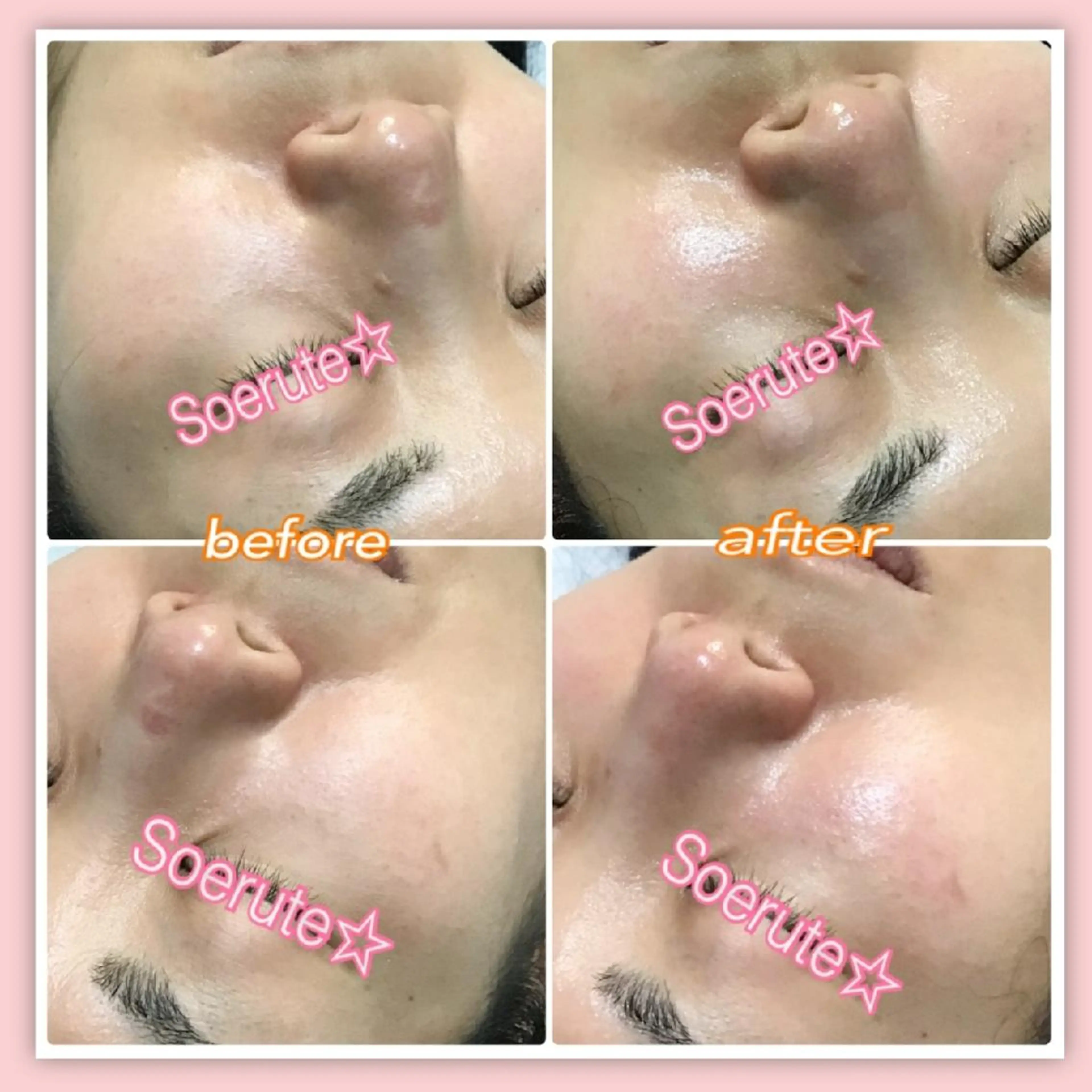 Soerute☆ ソエルテ 井上みえのエステ・リラクイメージ