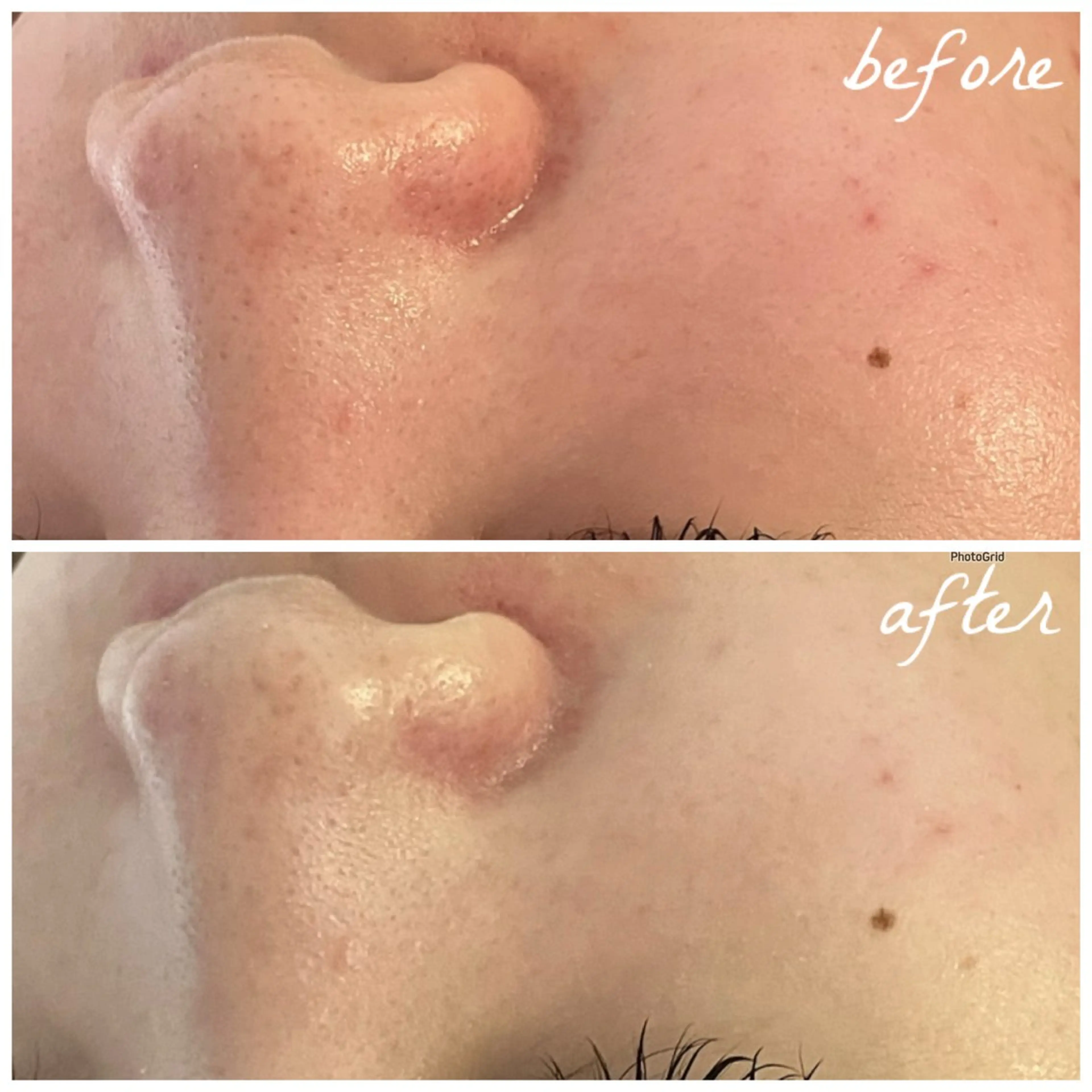 メンズ エステ メナード岐阜茜部 杉浦のエステ・リラクイメージ