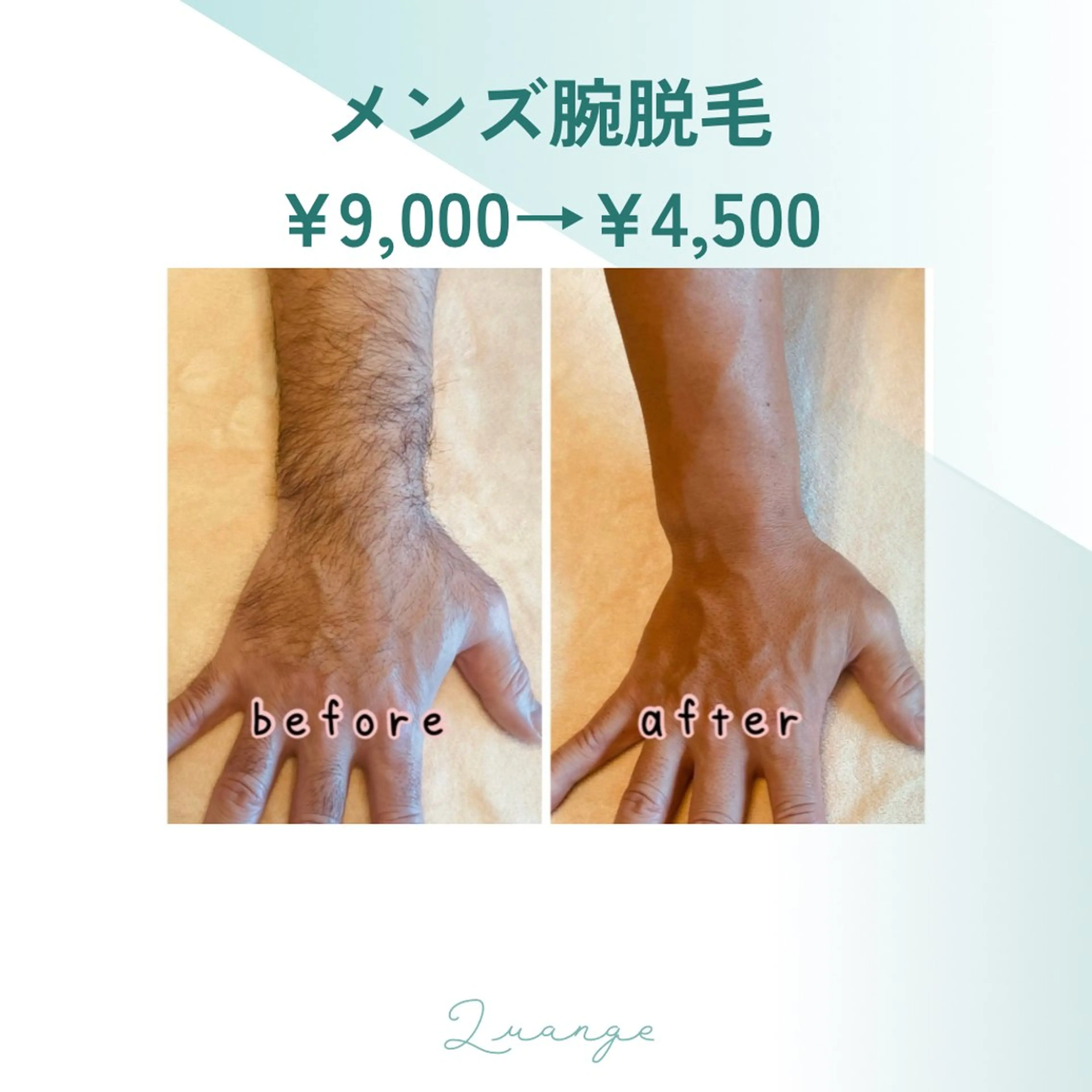 メンズ 脱毛 美肌脱毛エステサロン Luangeのエステ・リラクイメージ