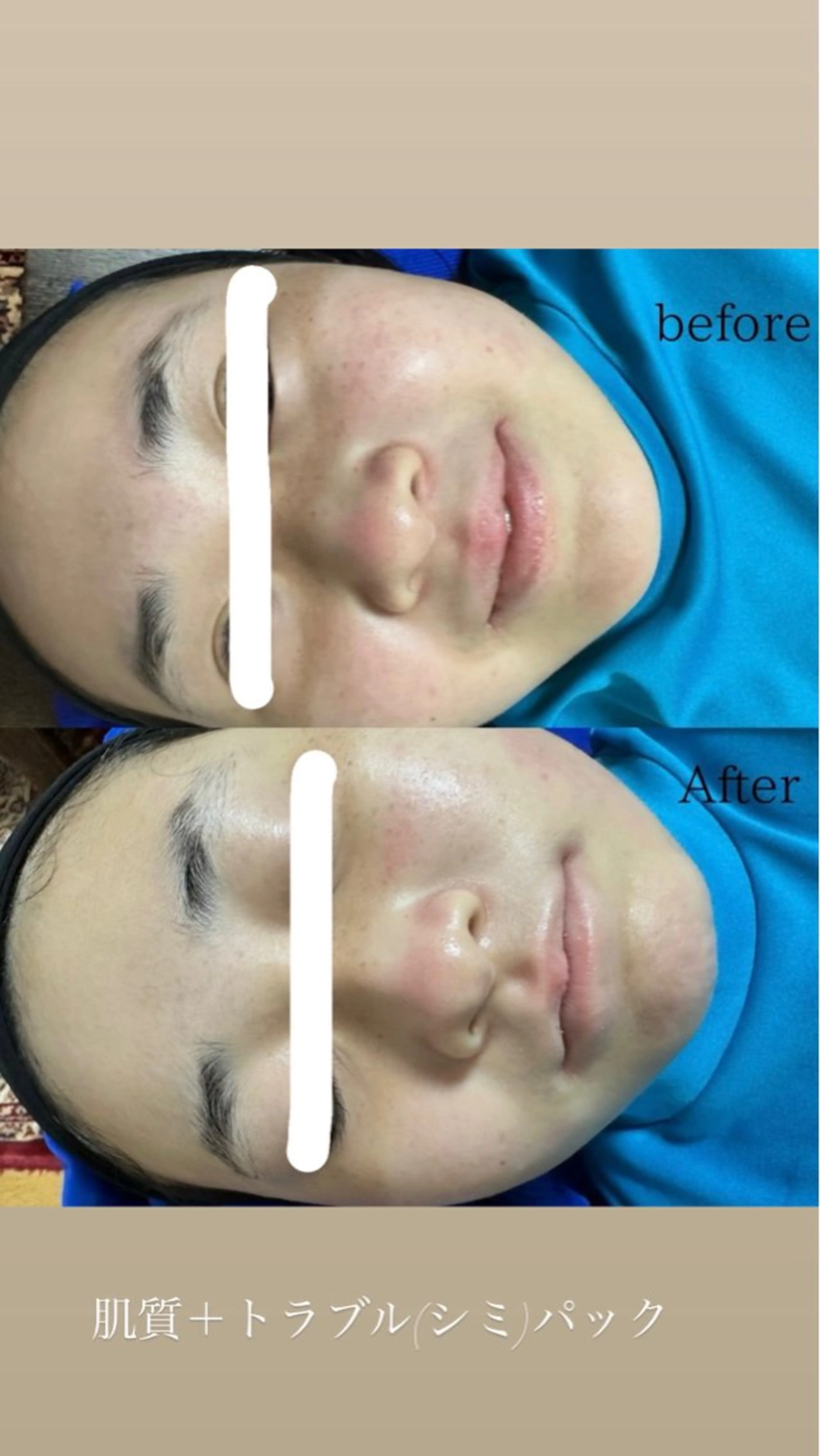 肌質/体質改善 久下玲菜のエステ・リラクイメージ