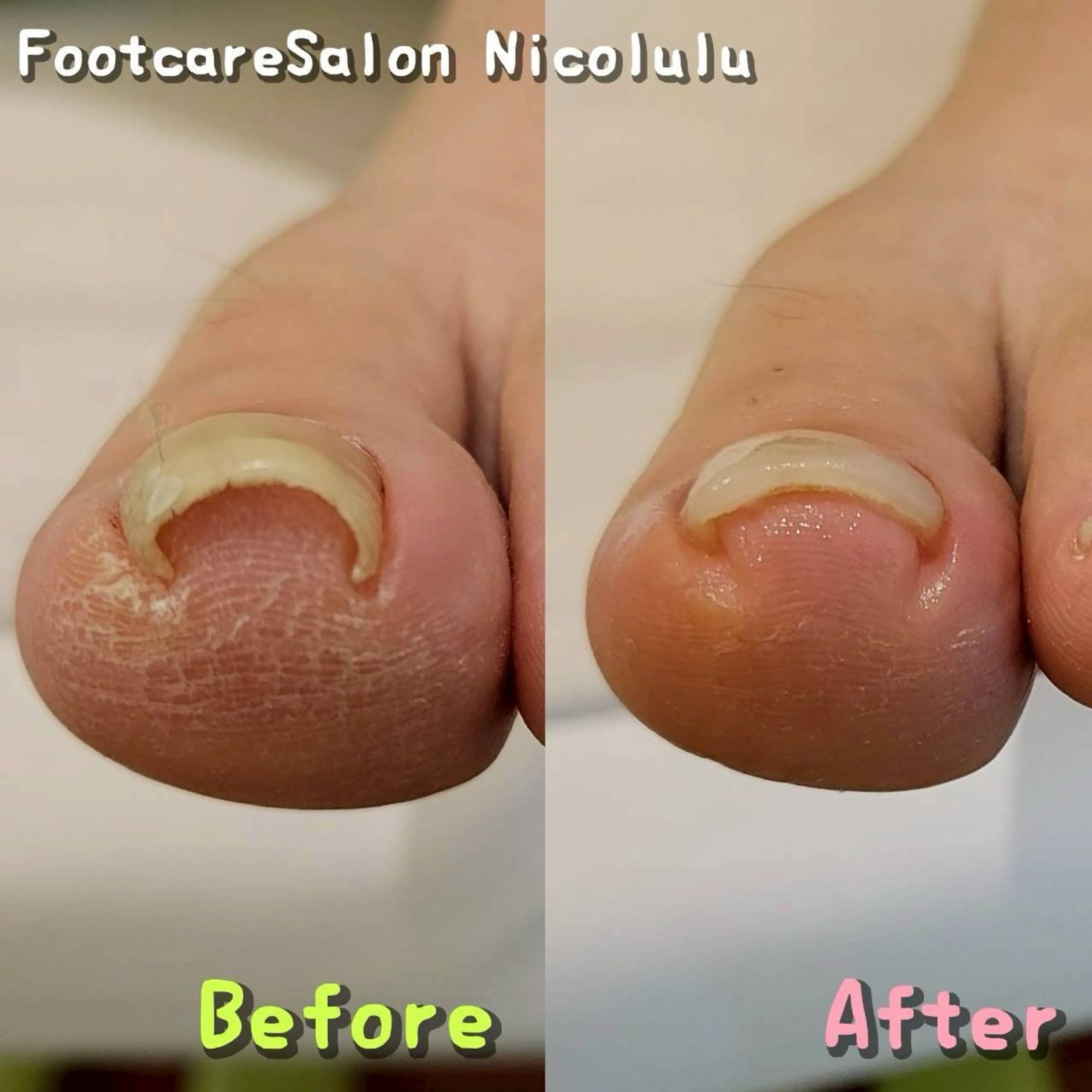 リラク 足トラブル専門 ニコルル金沢のエステ・リラクイメージ