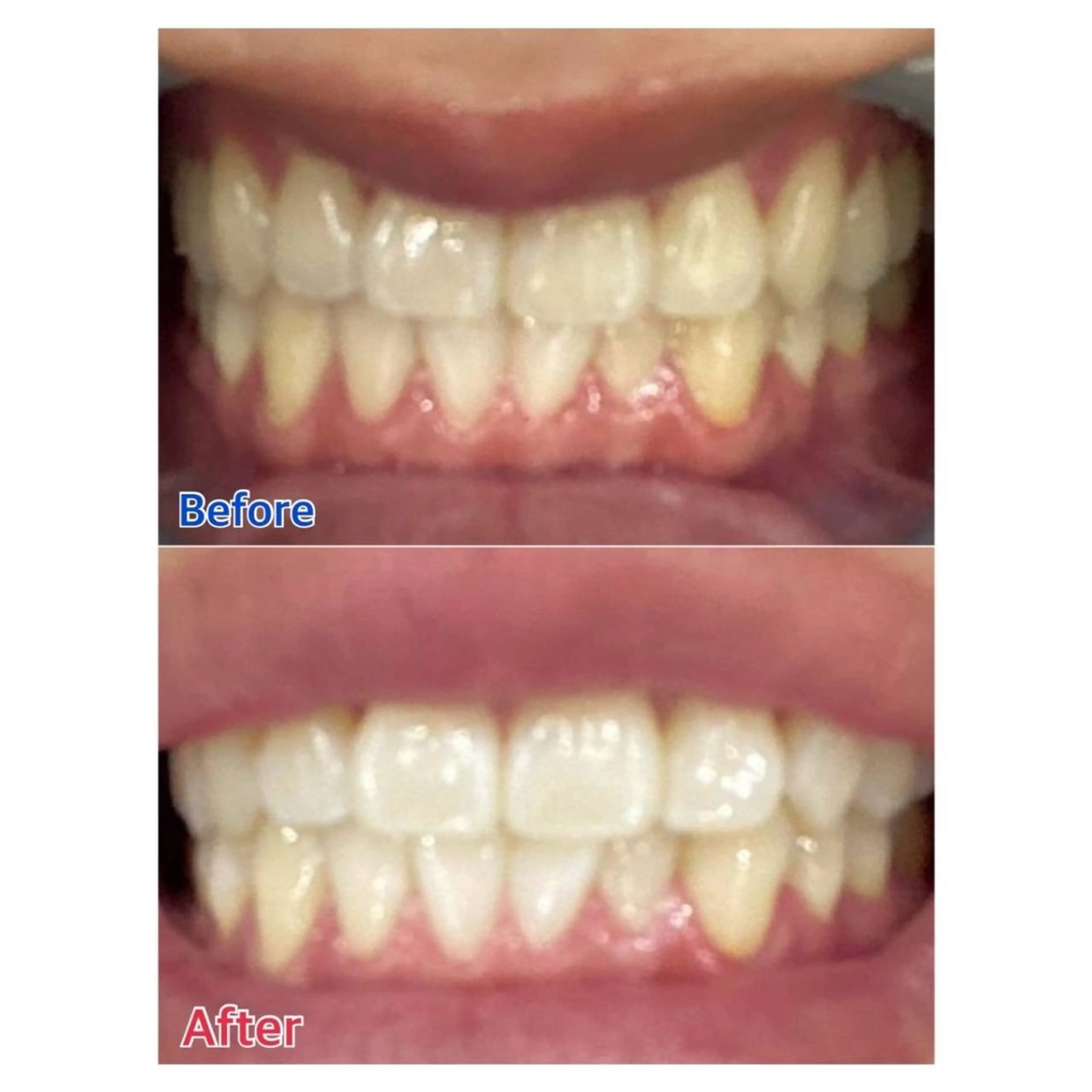 Melty 輝のその他イメージ