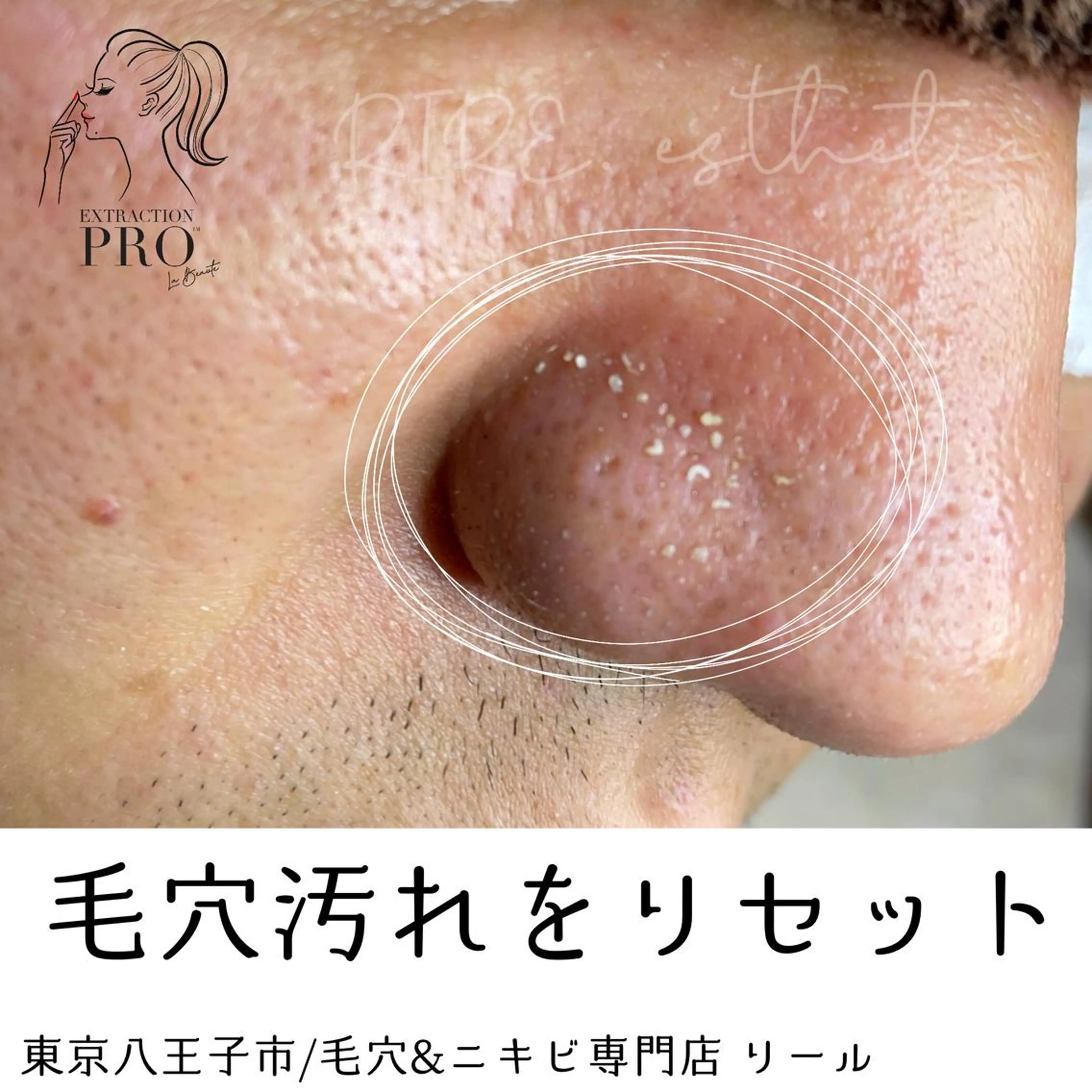 毛穴特化エステ -リールのエステ・リラクイメージ