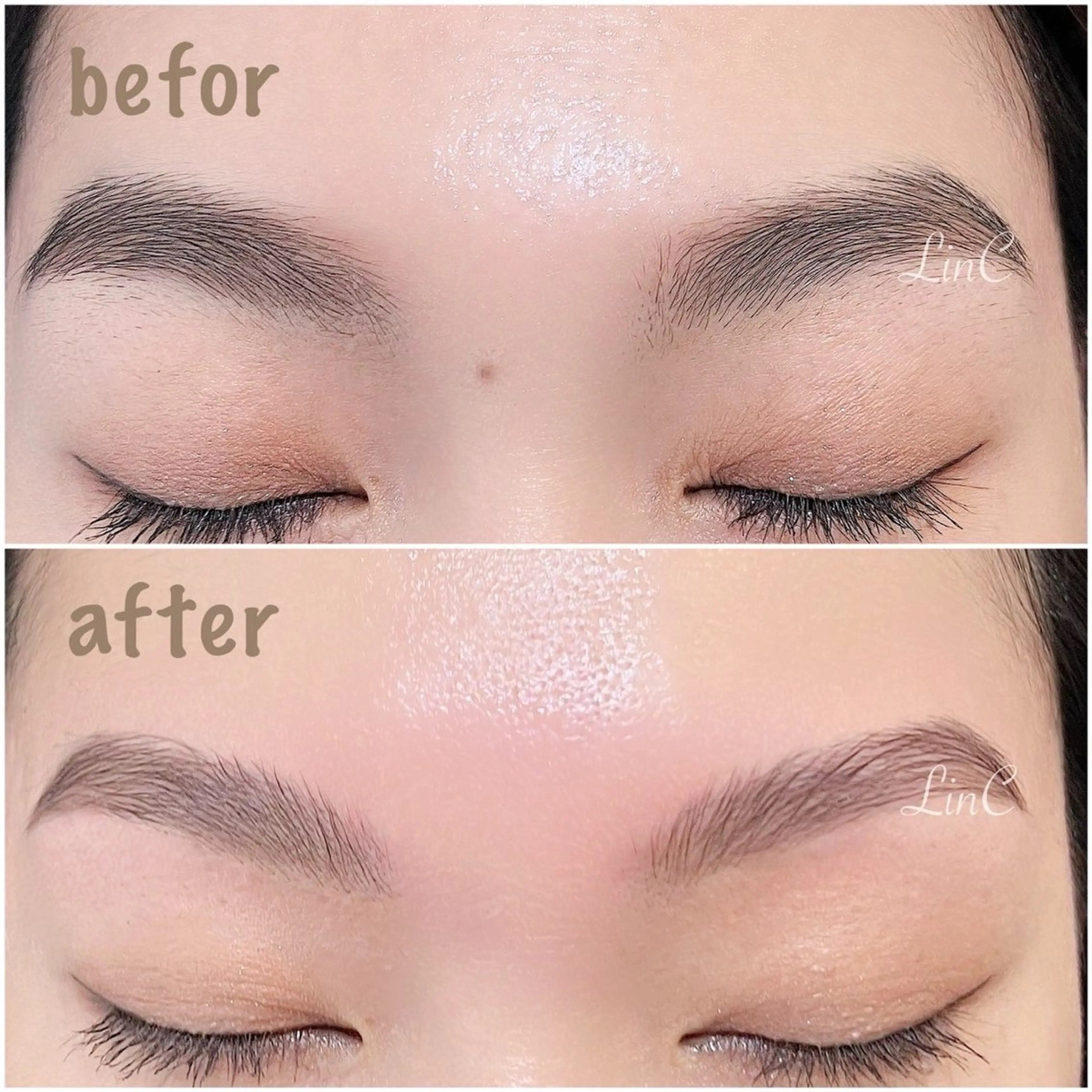 ブロウリフトの写真