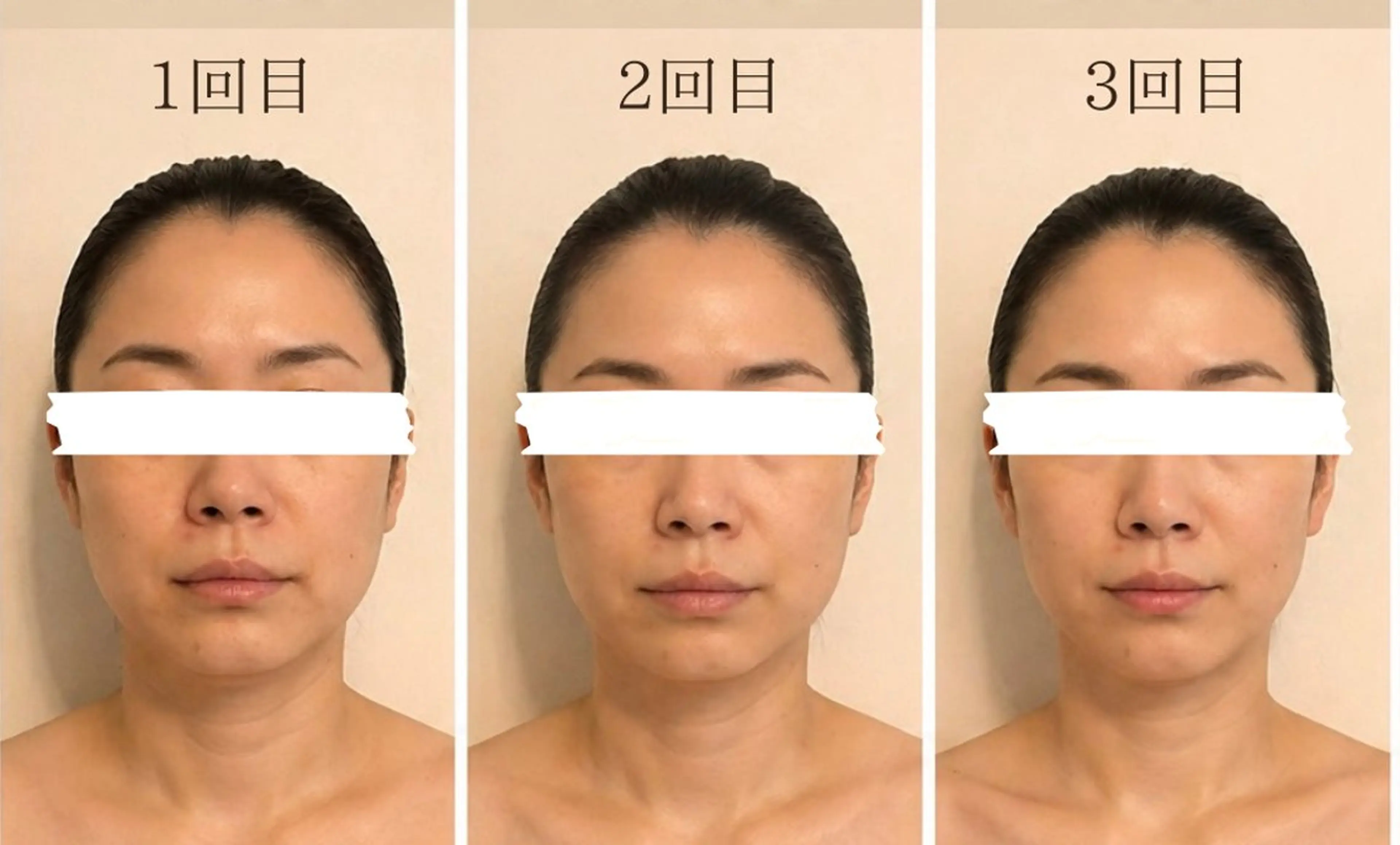 【首を長く、顔は小さく】巻き肩解消×本格オイルコルギ＋デコルテ流し（50分）の写真