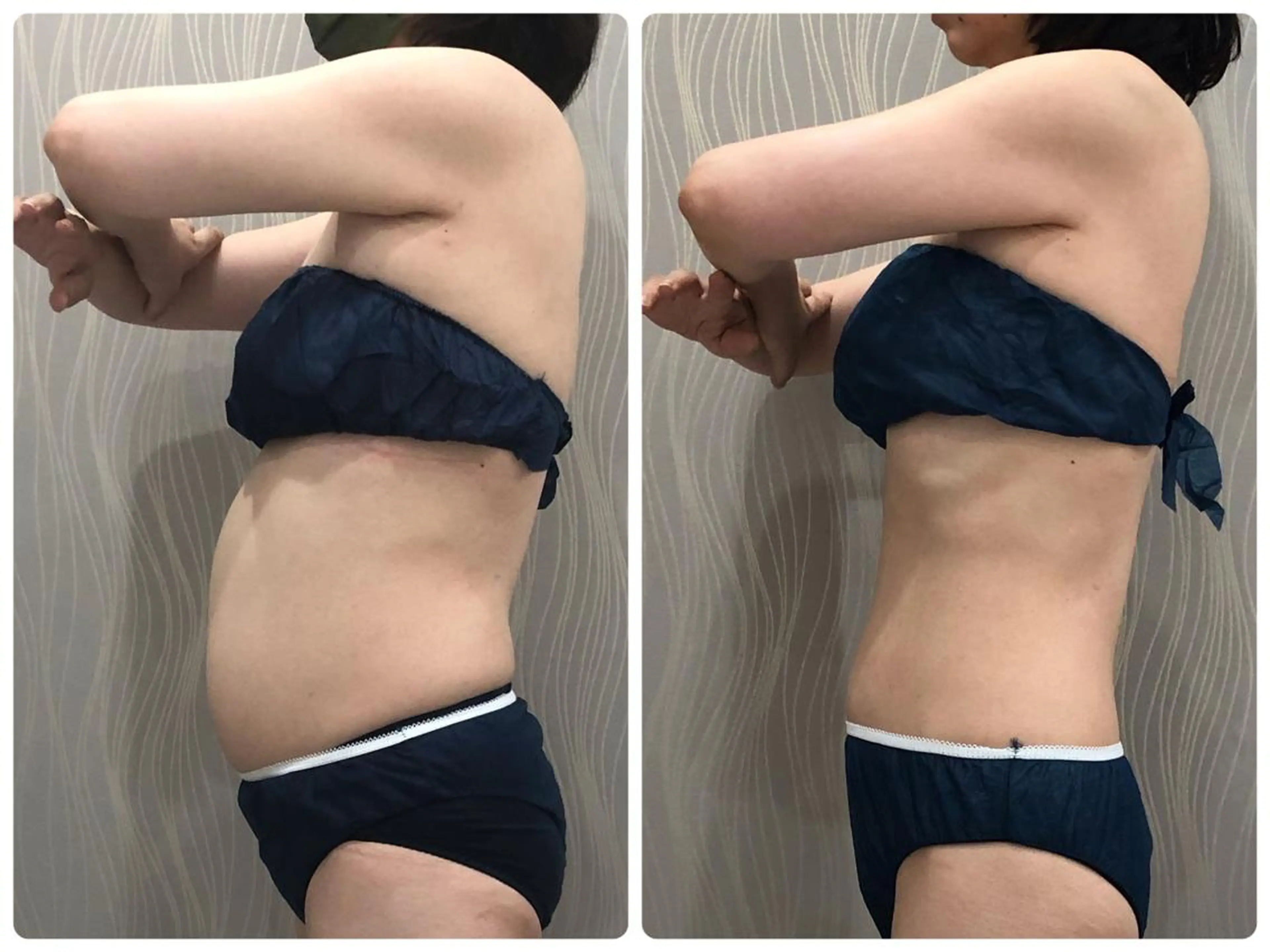 エステティックサロン ベルネのエステ・リラクイメージ