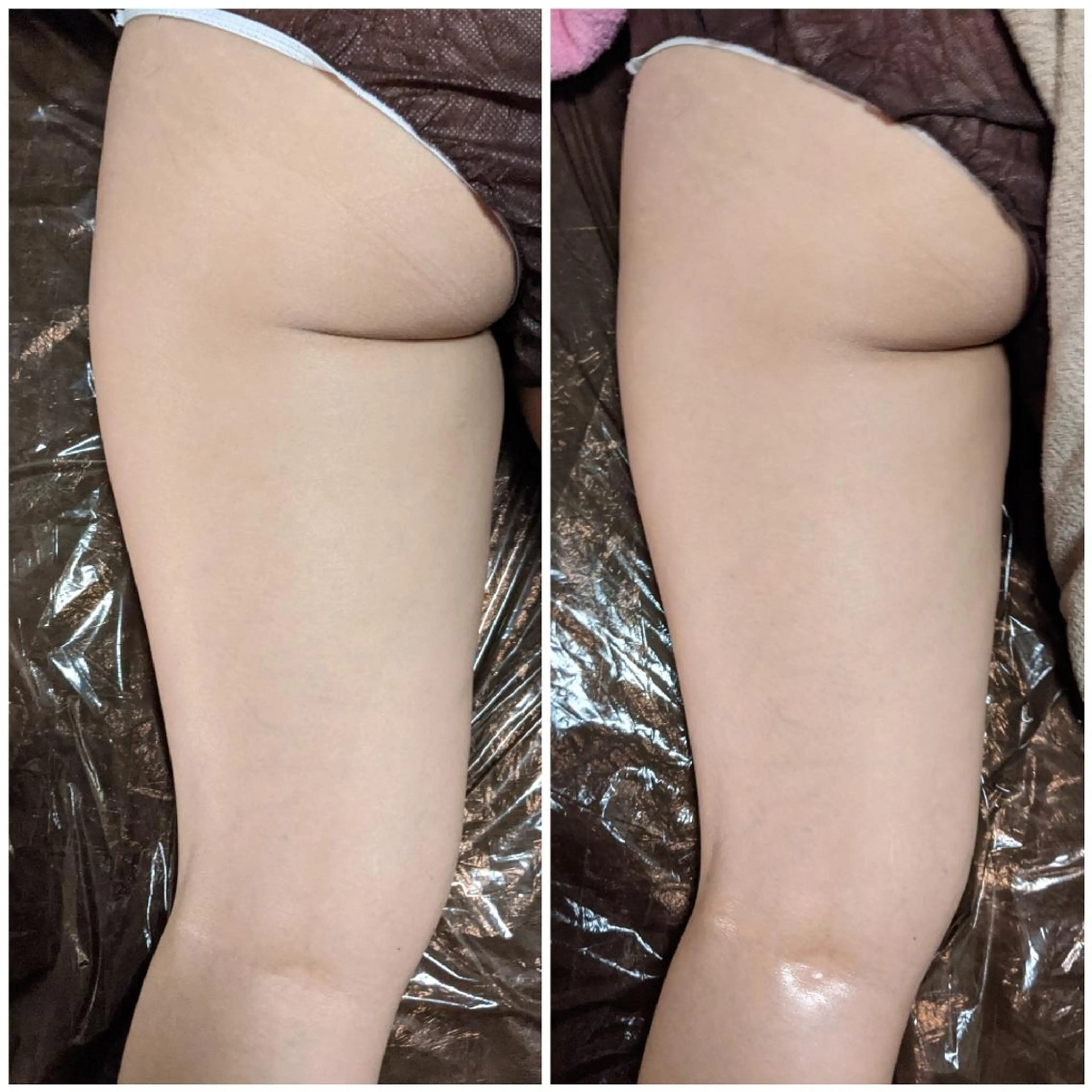 深層リンパオイル/小 顔とドライヘッドスパのエステ・リラクイメージ