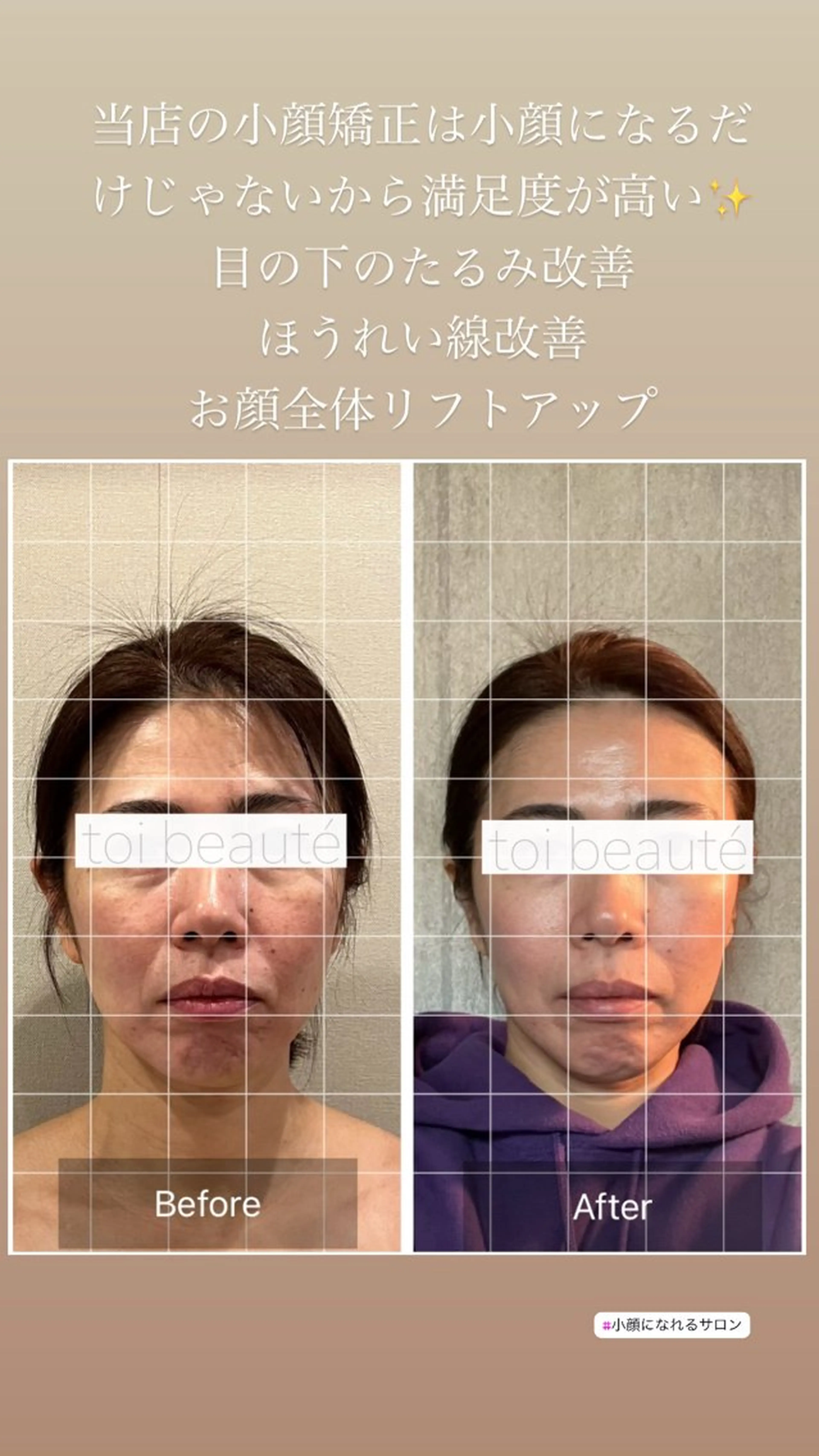 柳瀬 絵美のマツエク・マツパデザイン