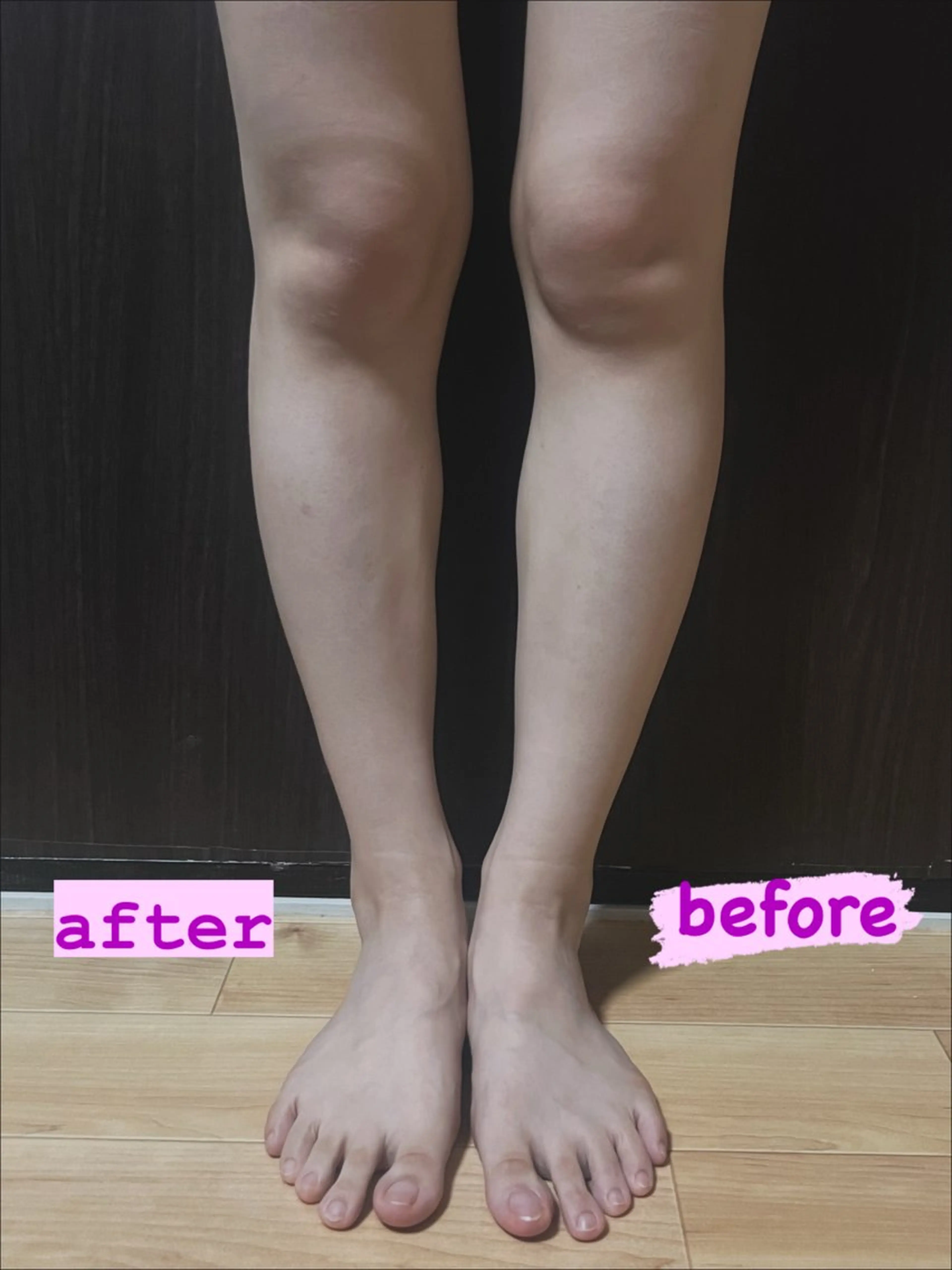 その他 Lokahi所属・全身脱毛/リラク Lokahiのエステ・リラクイメージ