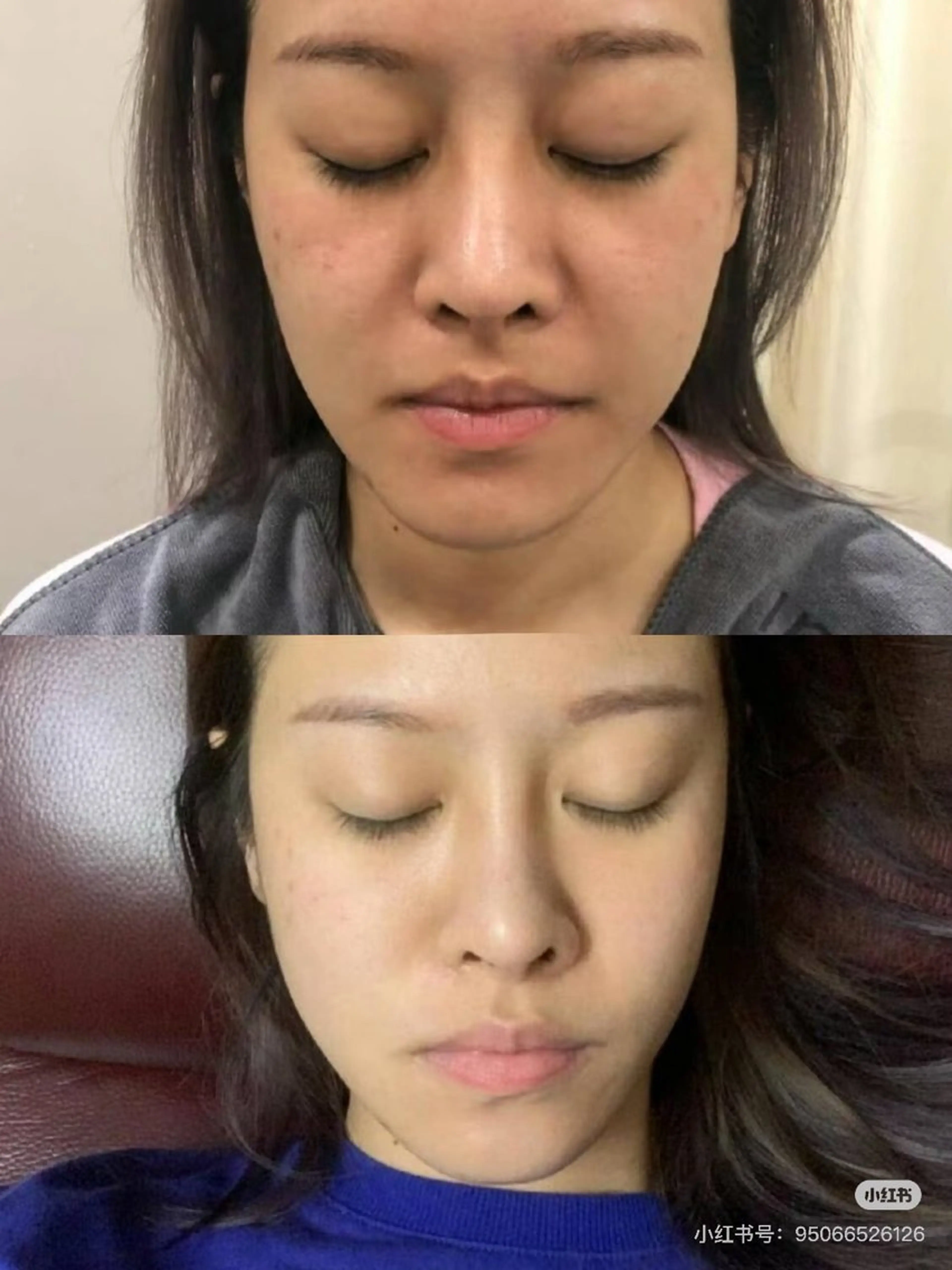 マツエク・マツパ エステ aliaハイフ&水光ジェットサロン所属・aliaハーブ水光店 エステティシャン募集のエステ・リラクイメージ