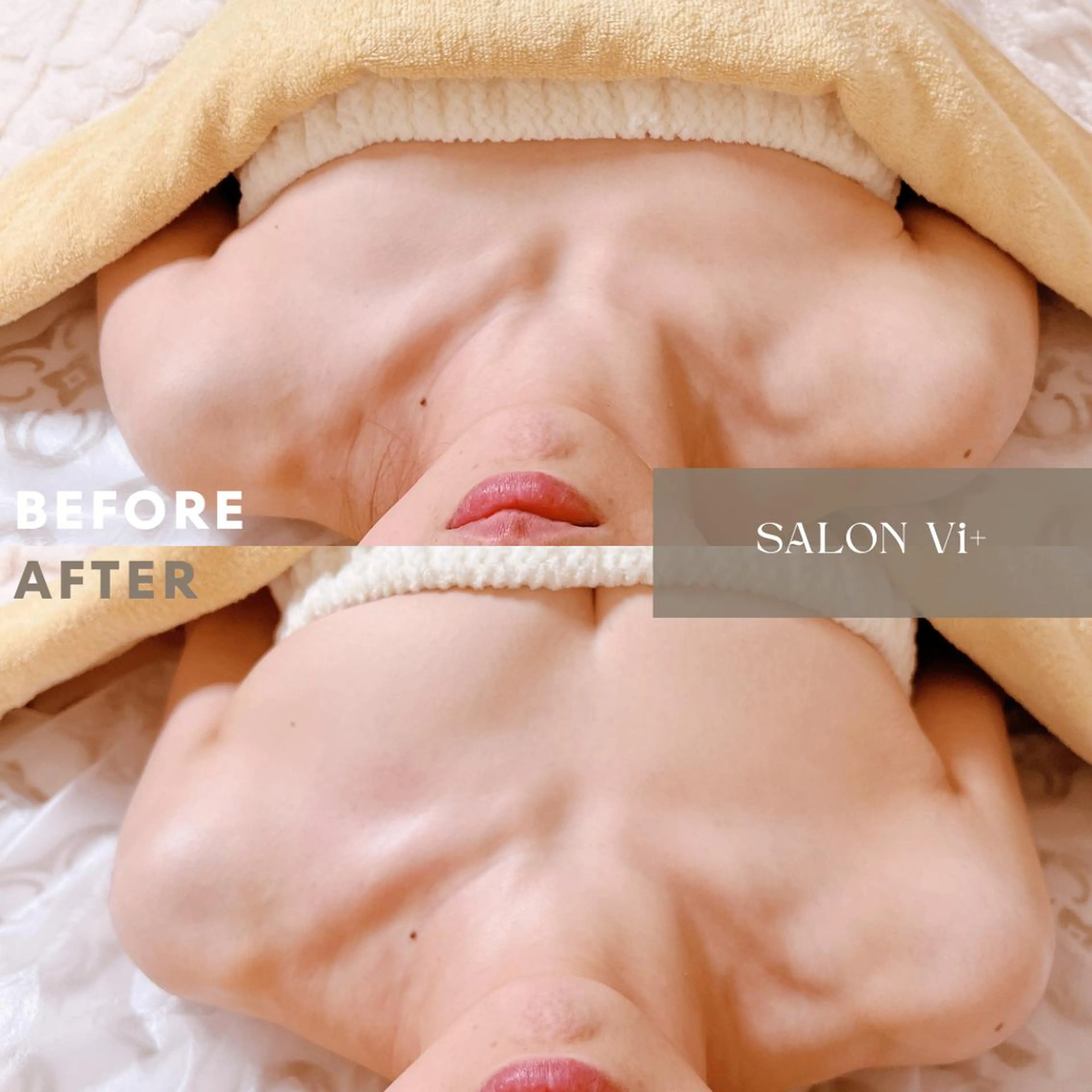 脱・おばさん体型！バスト位置を3cm上げて見た目年齢−5歳。本気のエイジングバストケアの写真