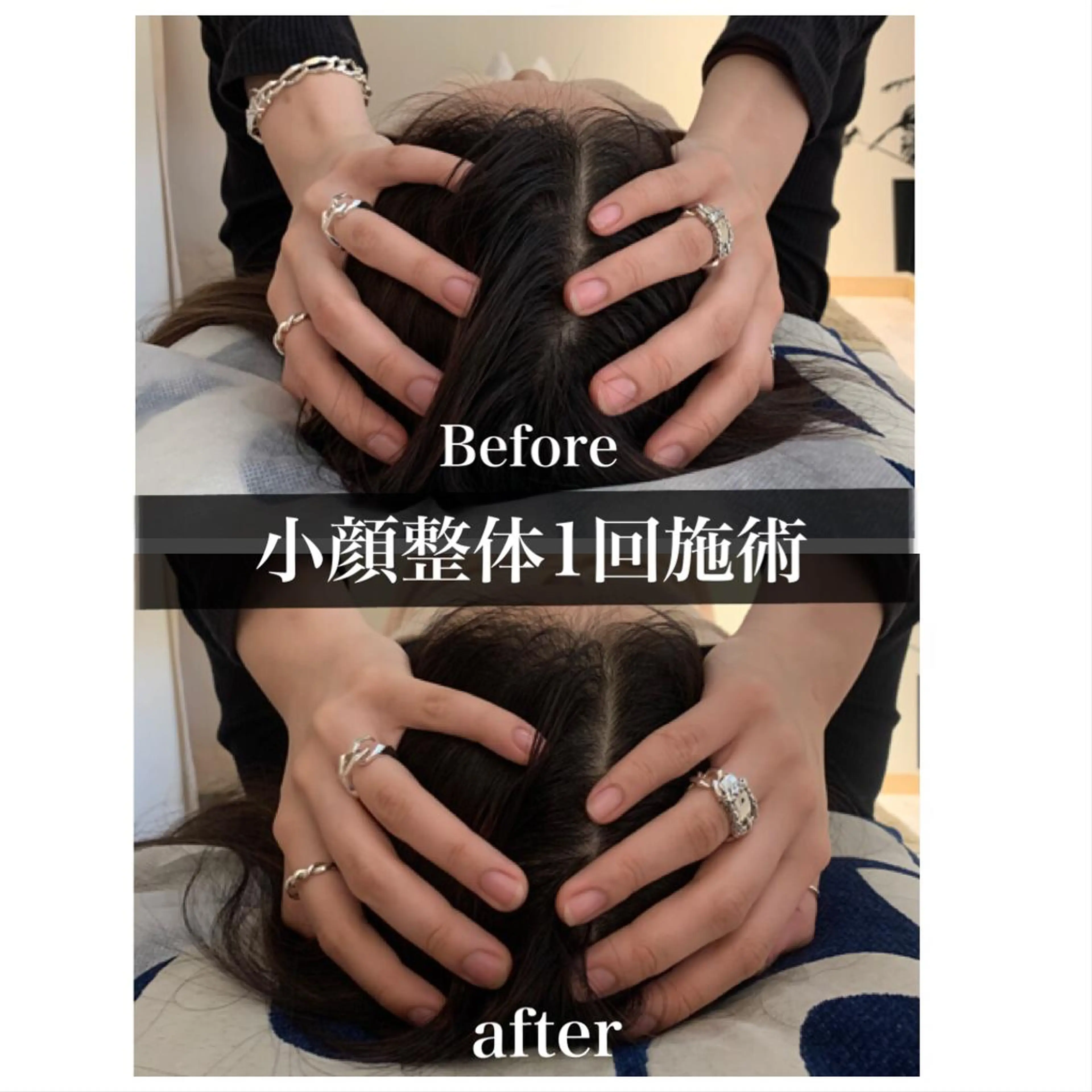 鍼灸 Refineのその他イメージ
