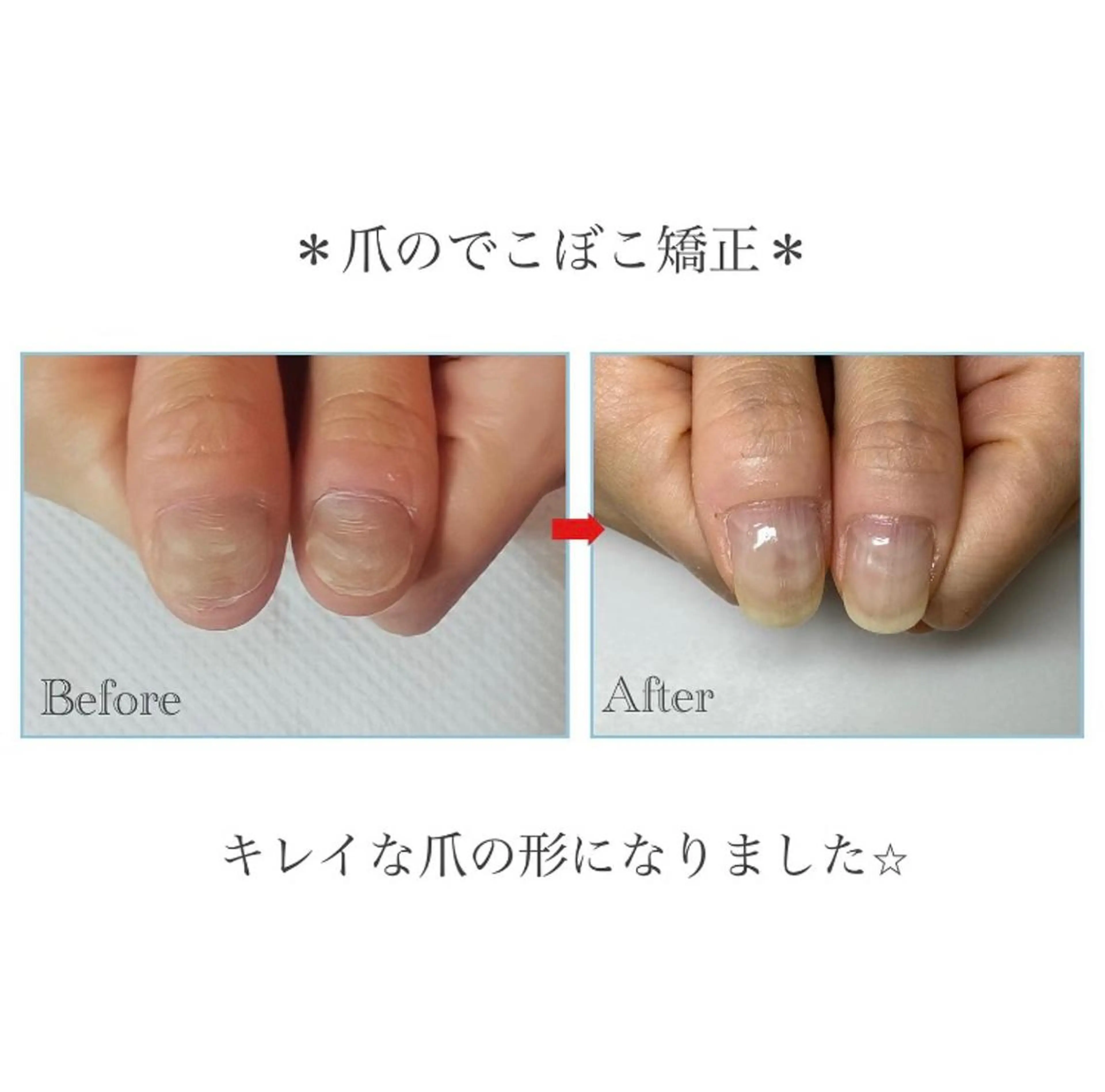 ネイル ネイルサロン アリュームのネイルデザイン