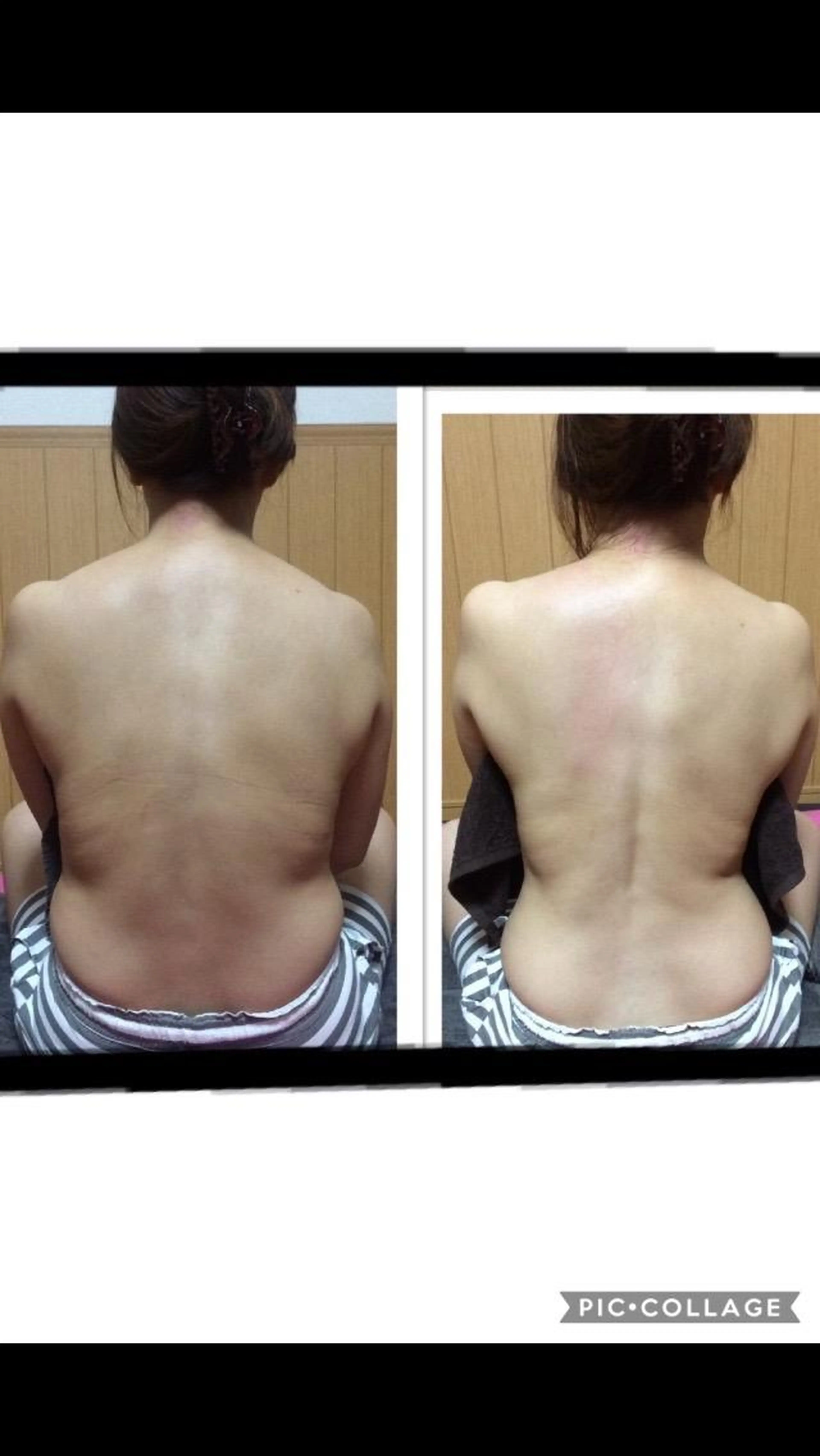 キャンペーン🔥ウエストくびれ、お腹ポッコリ撃退✨@新宿御苑前駅の系列店にて⭐️1ヶ月以内に2回施術分の写真