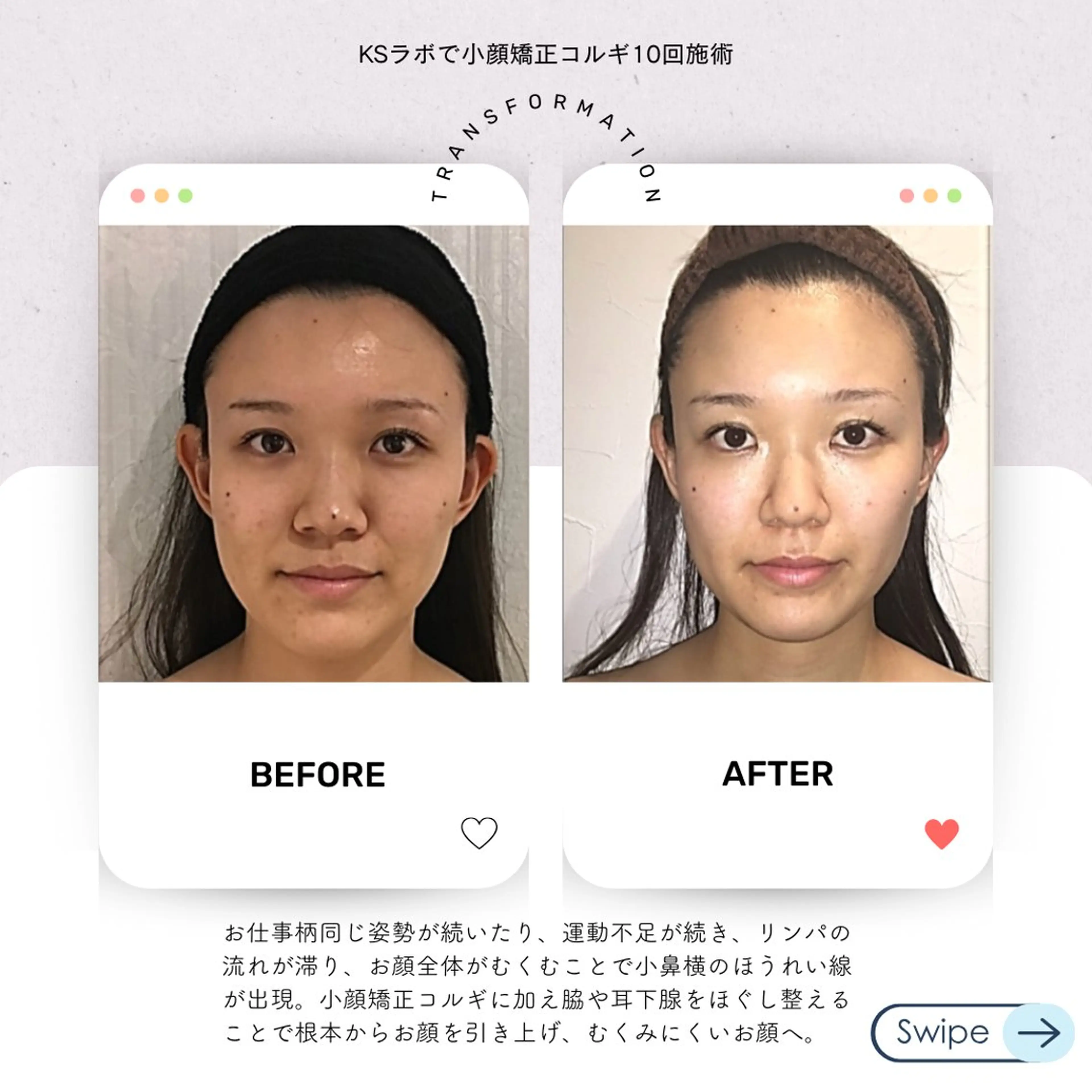 小顔整体研究所 KSラボ北千住店のエステ・リラクイメージ