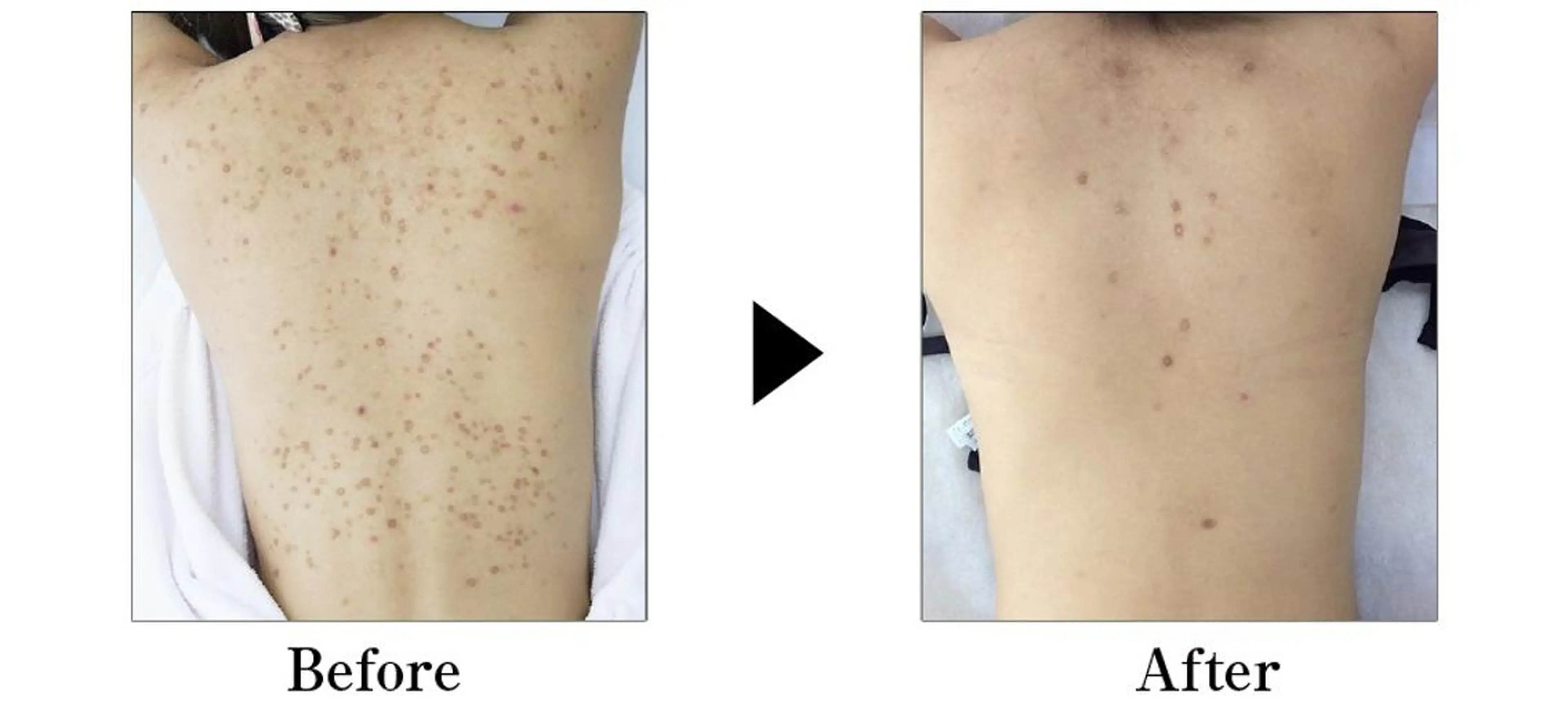 マツエク・マツパ ネイル ヘアアレンジ カラー パーマ メンズ キッズ セミロング 次世代まつげパーマは 『リベル名古屋』のマツエク・マツパデザイン