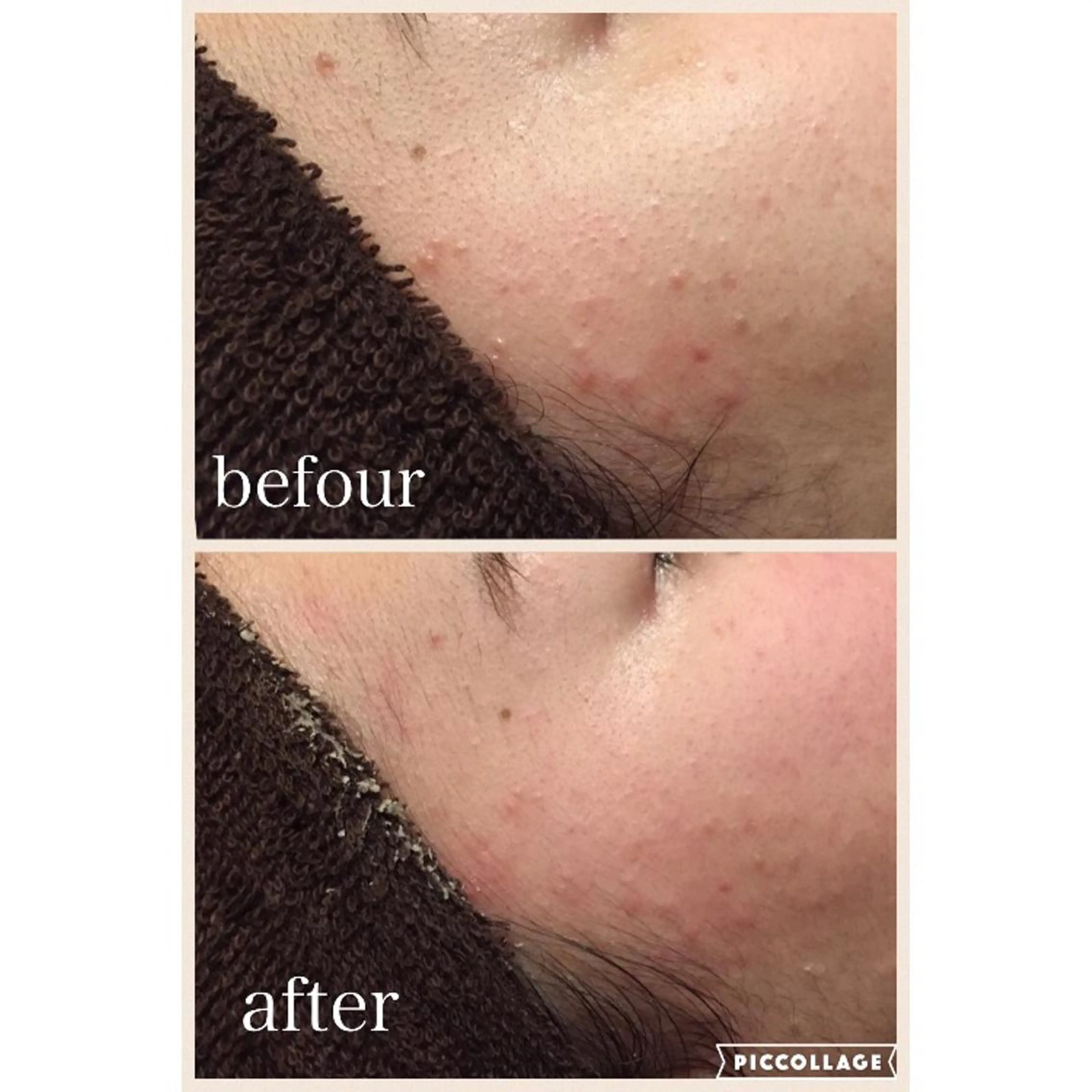 ニキビ跡専門サロン Ａｉｎａのエステ・リラクイメージ