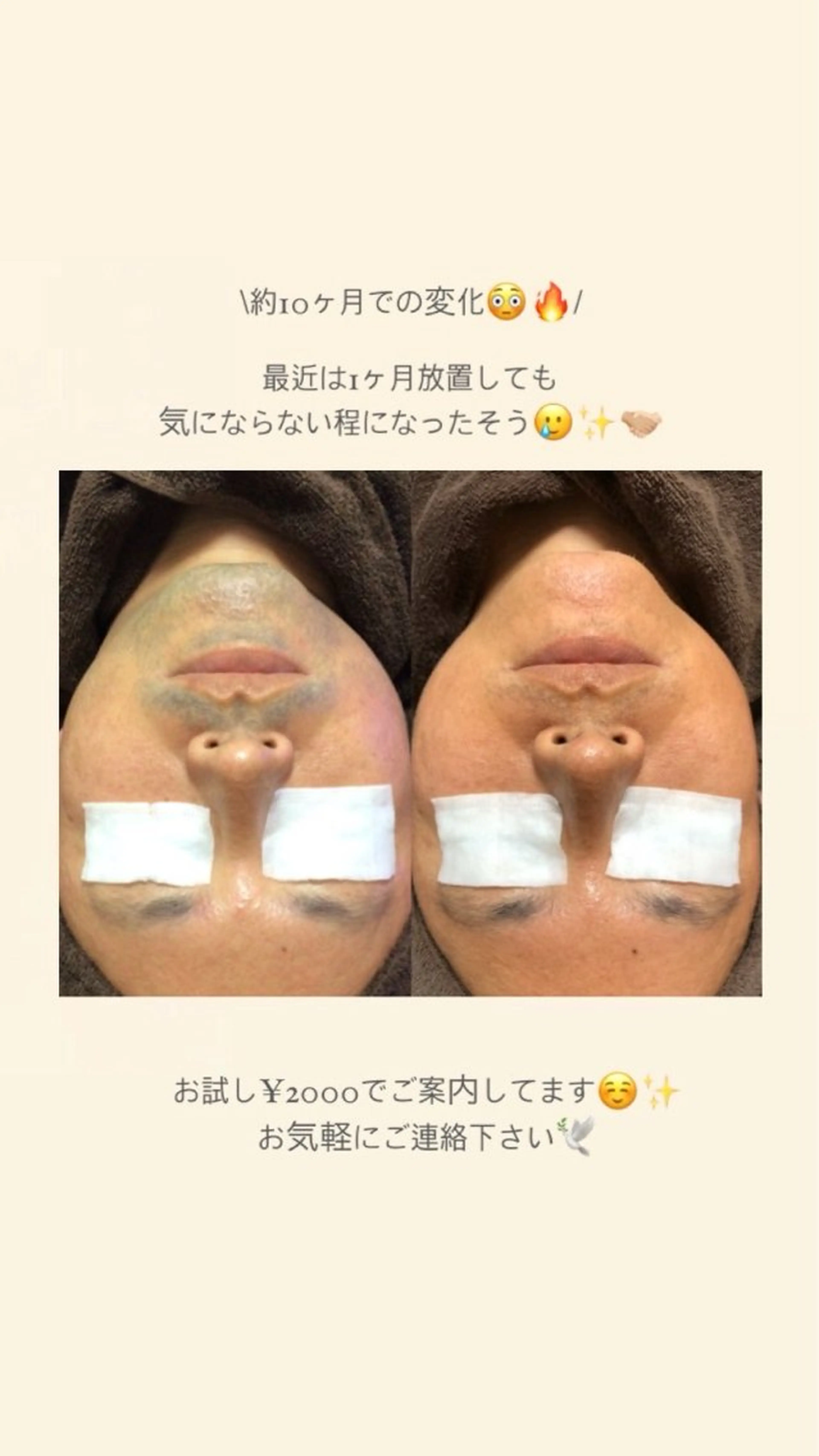 エステサロン LANA.のエステ・リラクイメージ