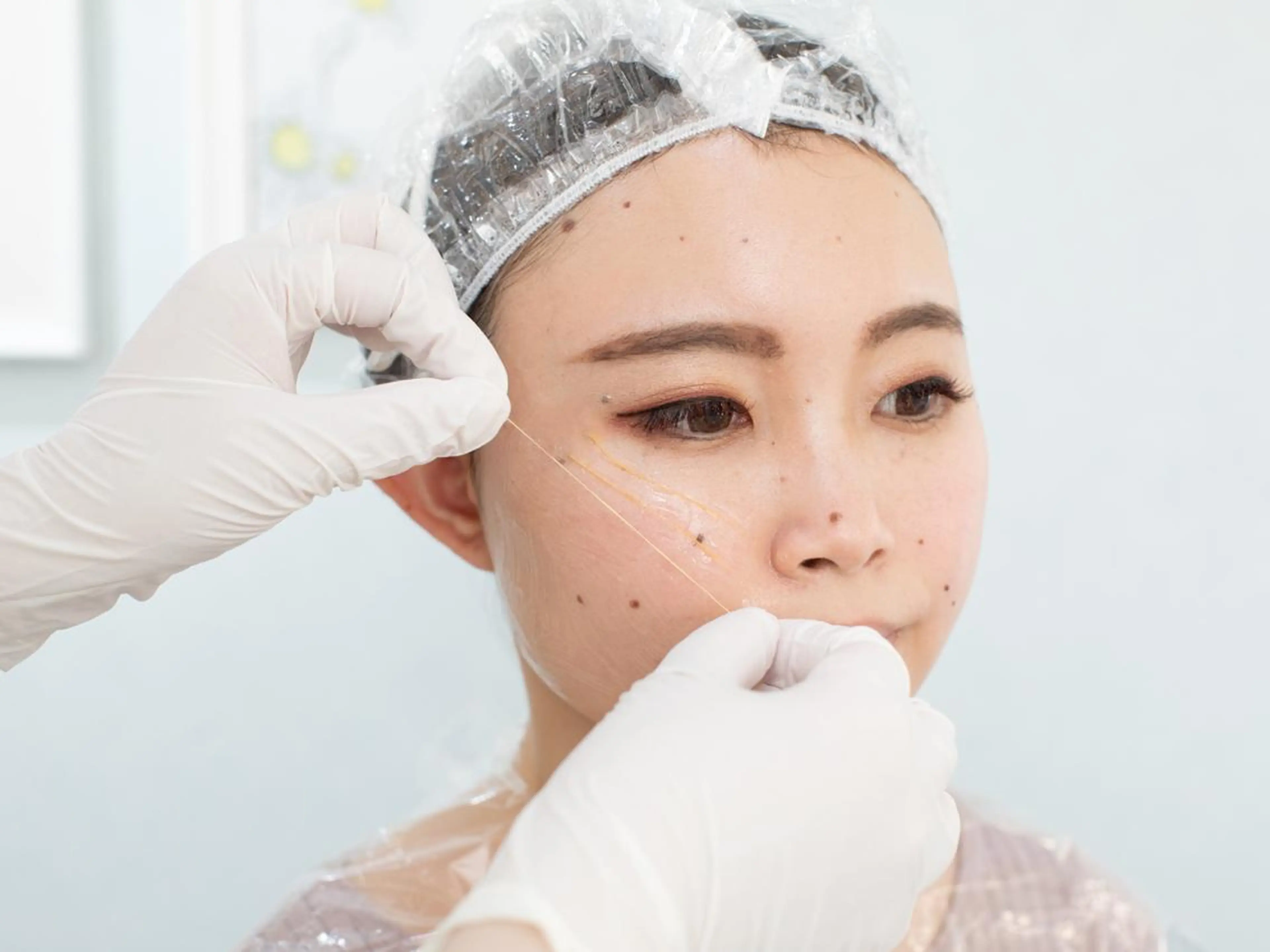 セラピスト施術【1Dayシンデレラ】コールドライン24本アレンジケア＋12000s🌟輝く小顔で💕美白＆美肌＆潤いの写真