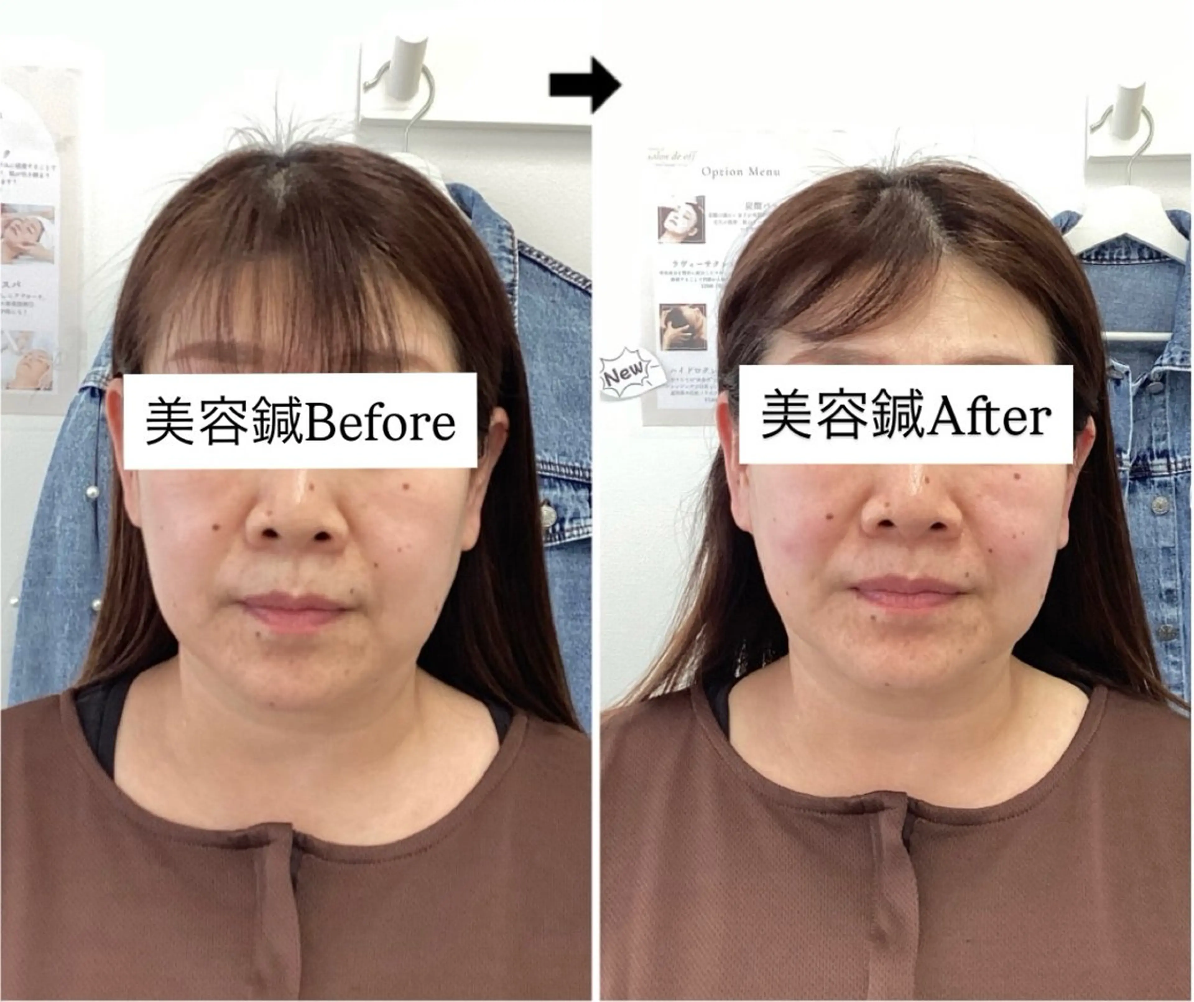 リラク 美容鍼灸×小顔整体♡ ハリサロンドオフ堺東のその他イメージ