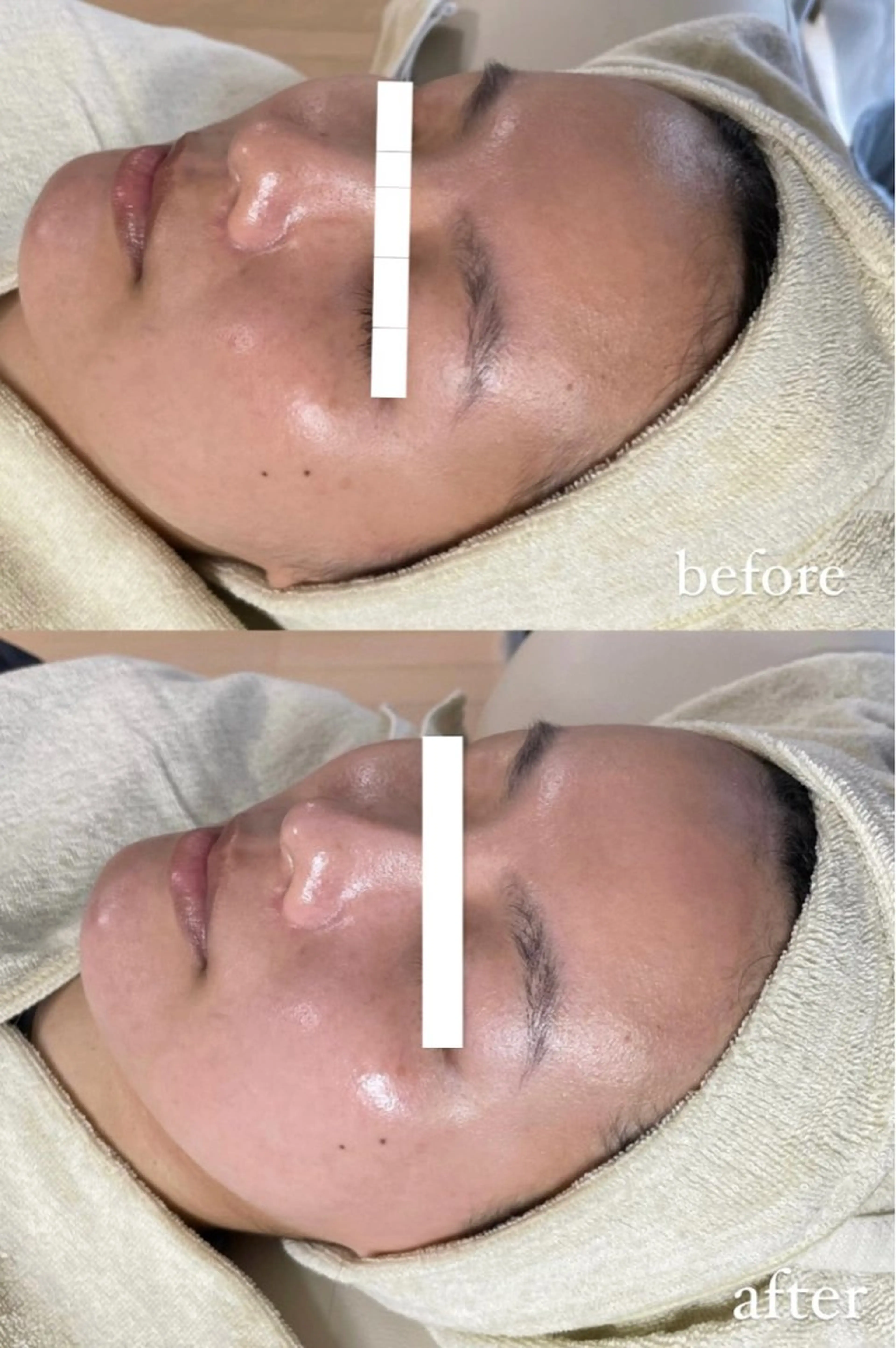 脱毛 エステサロン Mi-mi.iのエステ・リラクイメージ